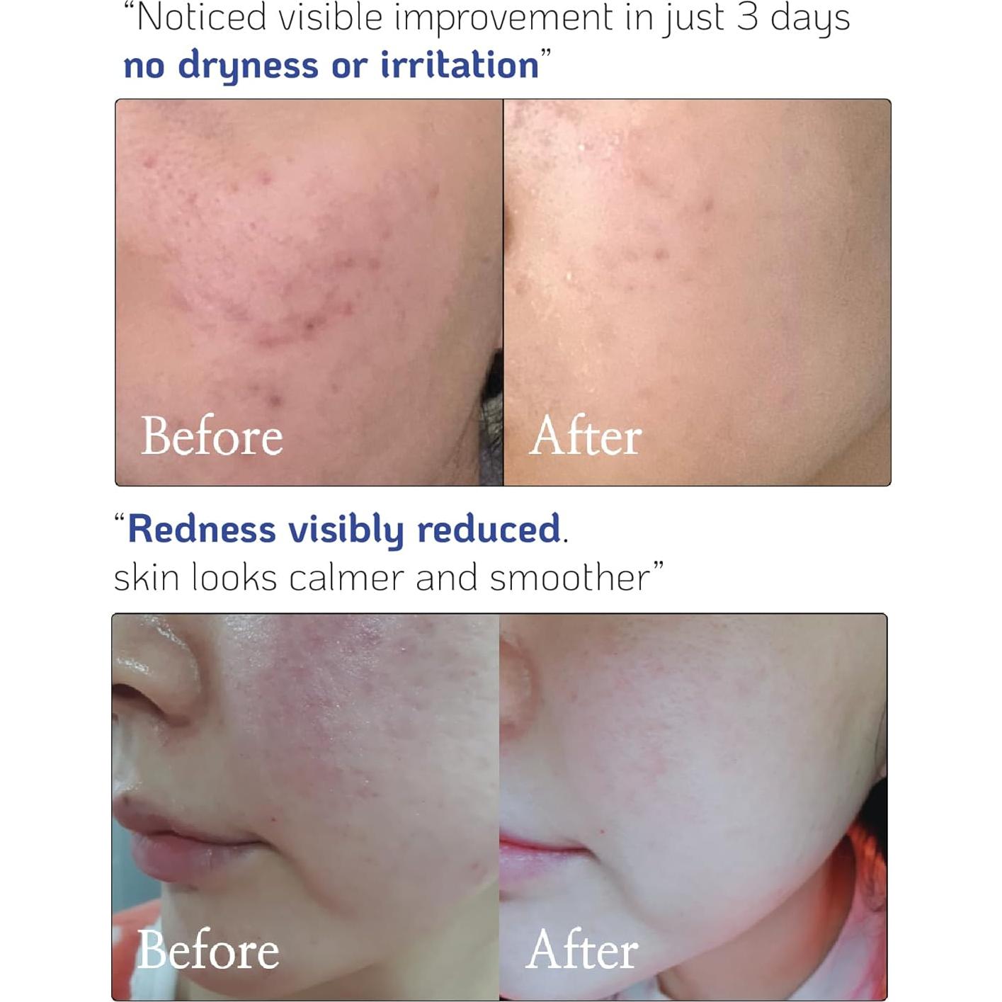 Concentrado de Ceramida Nano Recipe 41ml - Hidratante Regenerador