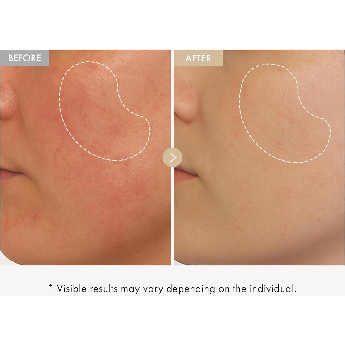 Sérum Facial TOSOWOONG de Arroz Real 33ml - Niacinamida y Alfa-Arbutina