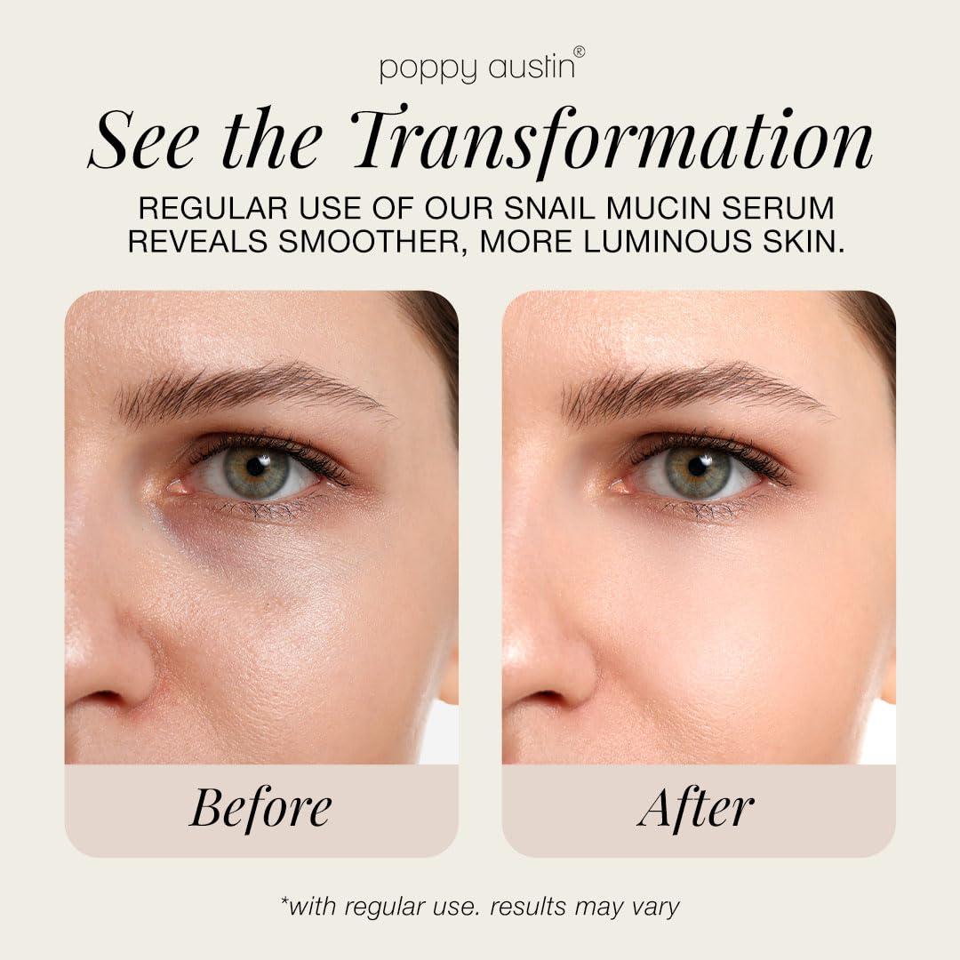 Suero Facial Poppy Austin 96% Mucina de Caracol 99.9ml