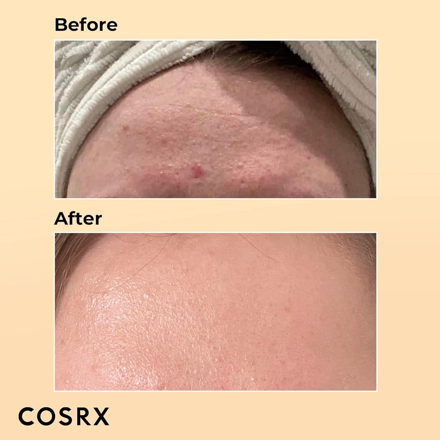 COSRX Set de Cuidado Facial: Esencia de Caracol 96% + Aceite de Retinol 0.5%