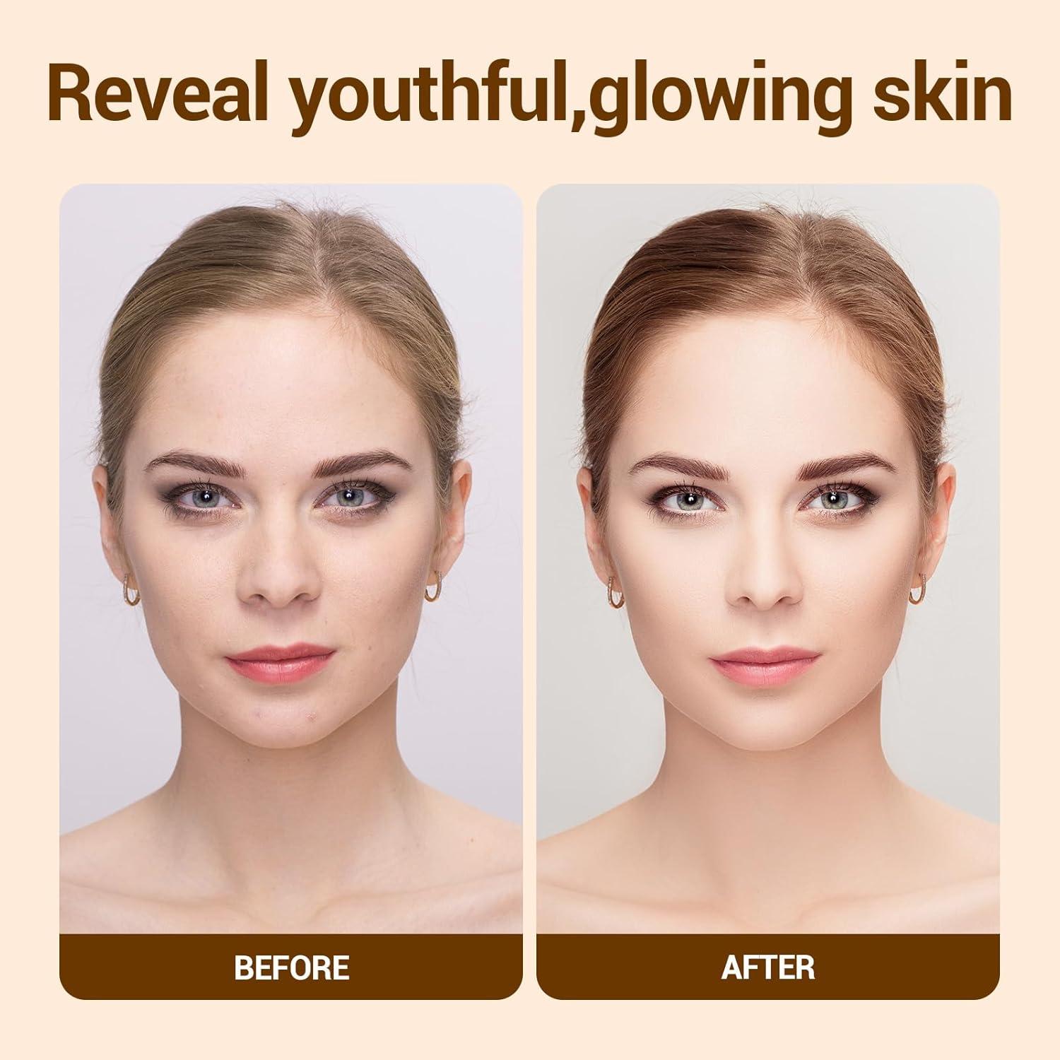 Crema Hidratante de Mucina de Caracol 125 ml Poeroes