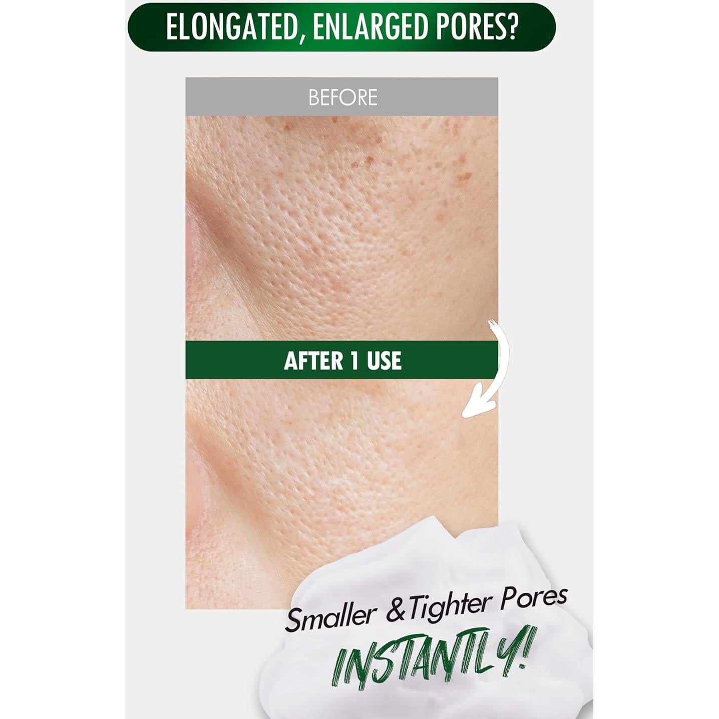 Mousse Exfoliante de Poros NEOGEN 100 ml Pore Zero