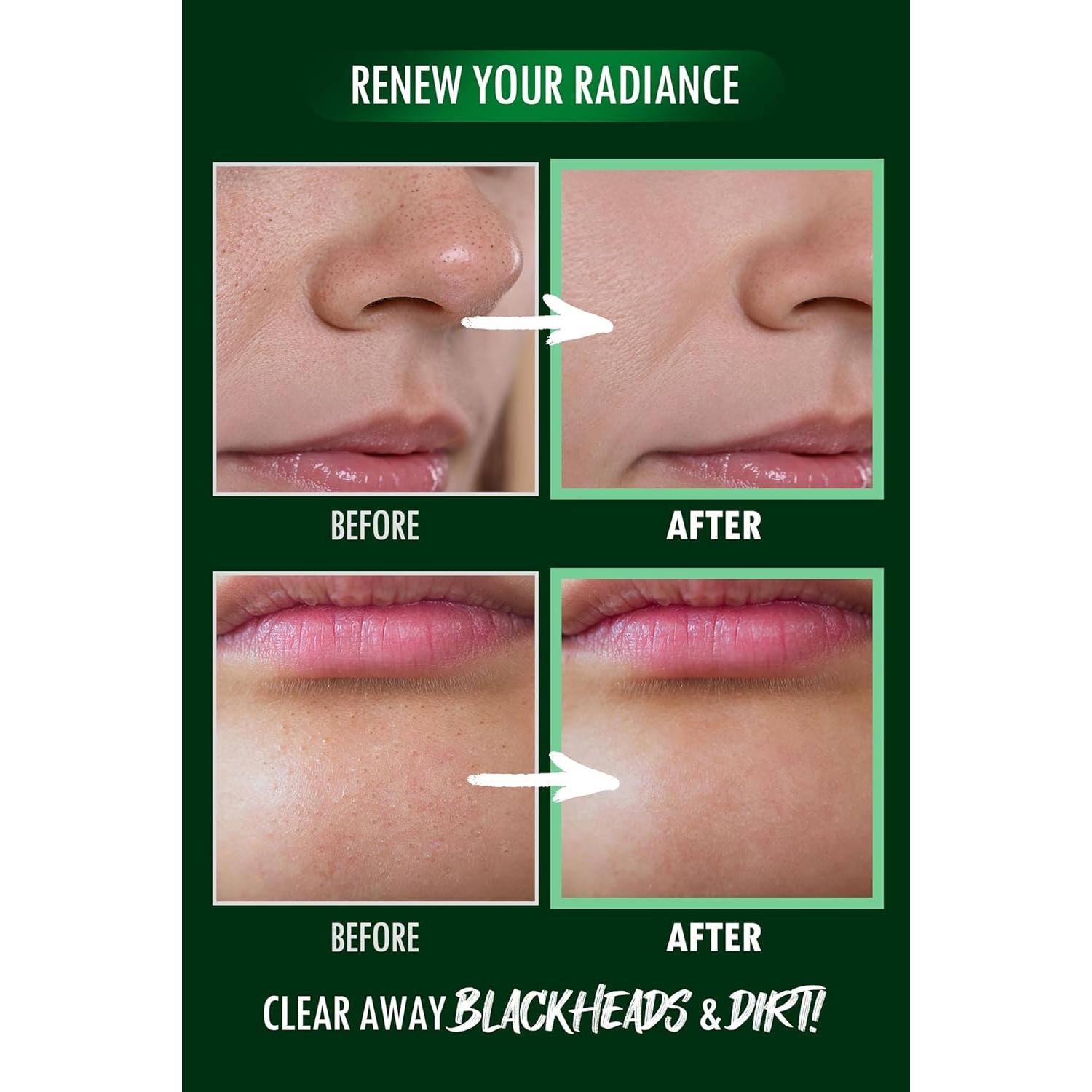 Mousse Exfoliante de Poros NEOGEN 100 ml Pore Zero