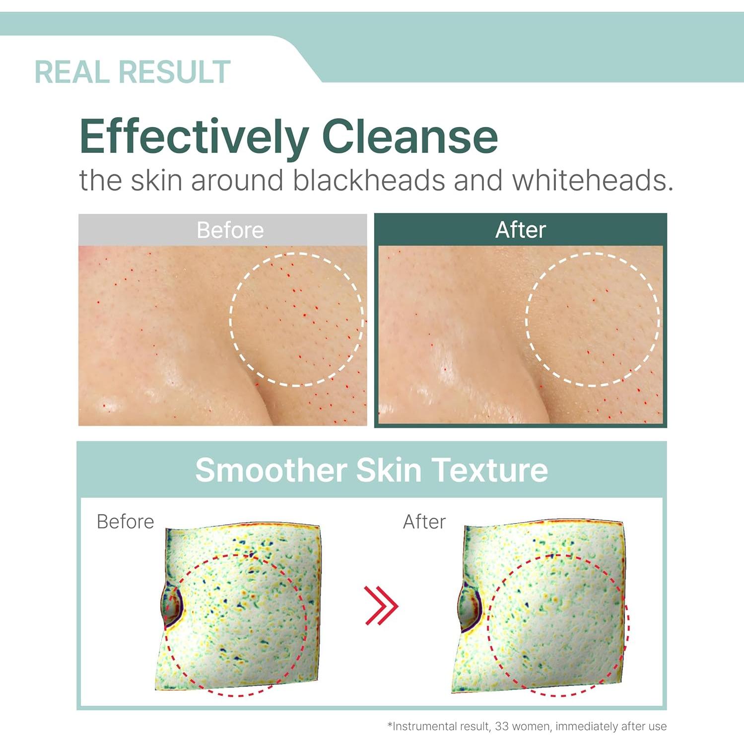 Illiyoon Aceite Limpiador Facial 250 ml - Sin Fragancia, AHA/BHA