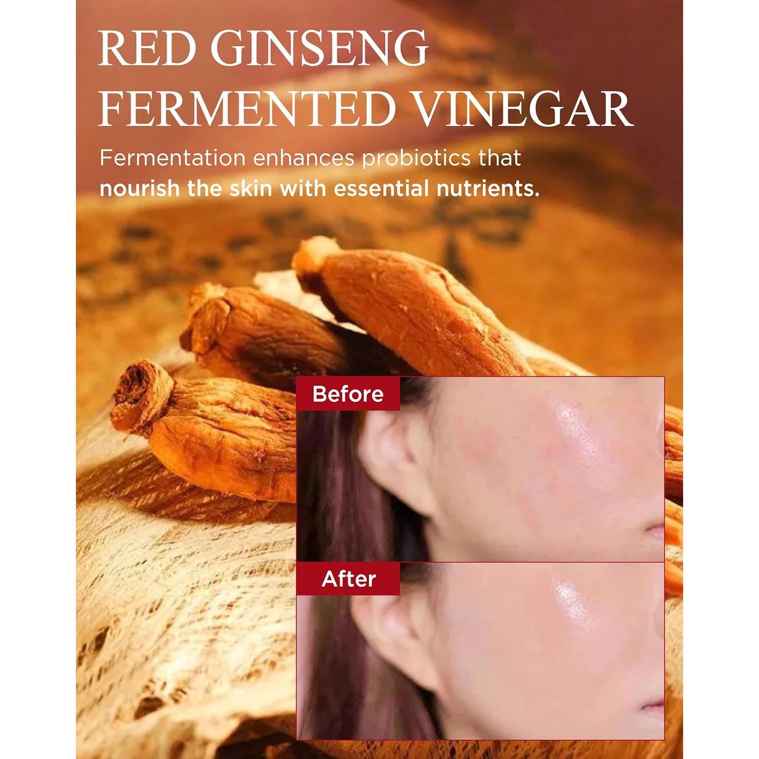 Esencia de Vinagre de Ginseng Rojo Bonyongo 44ml - Hidratante y Revitalizante