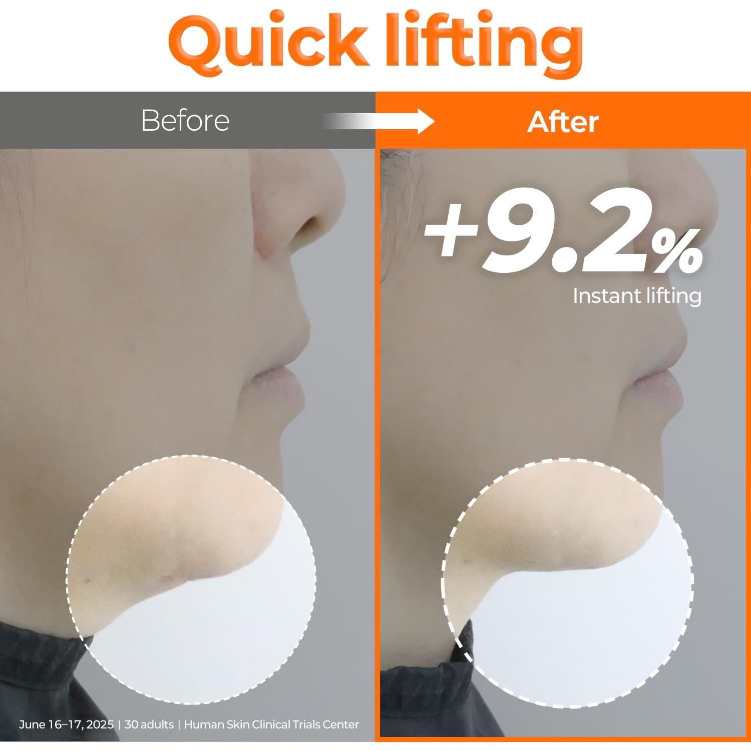 Máscara de Hidrogel de Péptidos SIGNIQ 34g x 3ea - Elevación y Firmeza