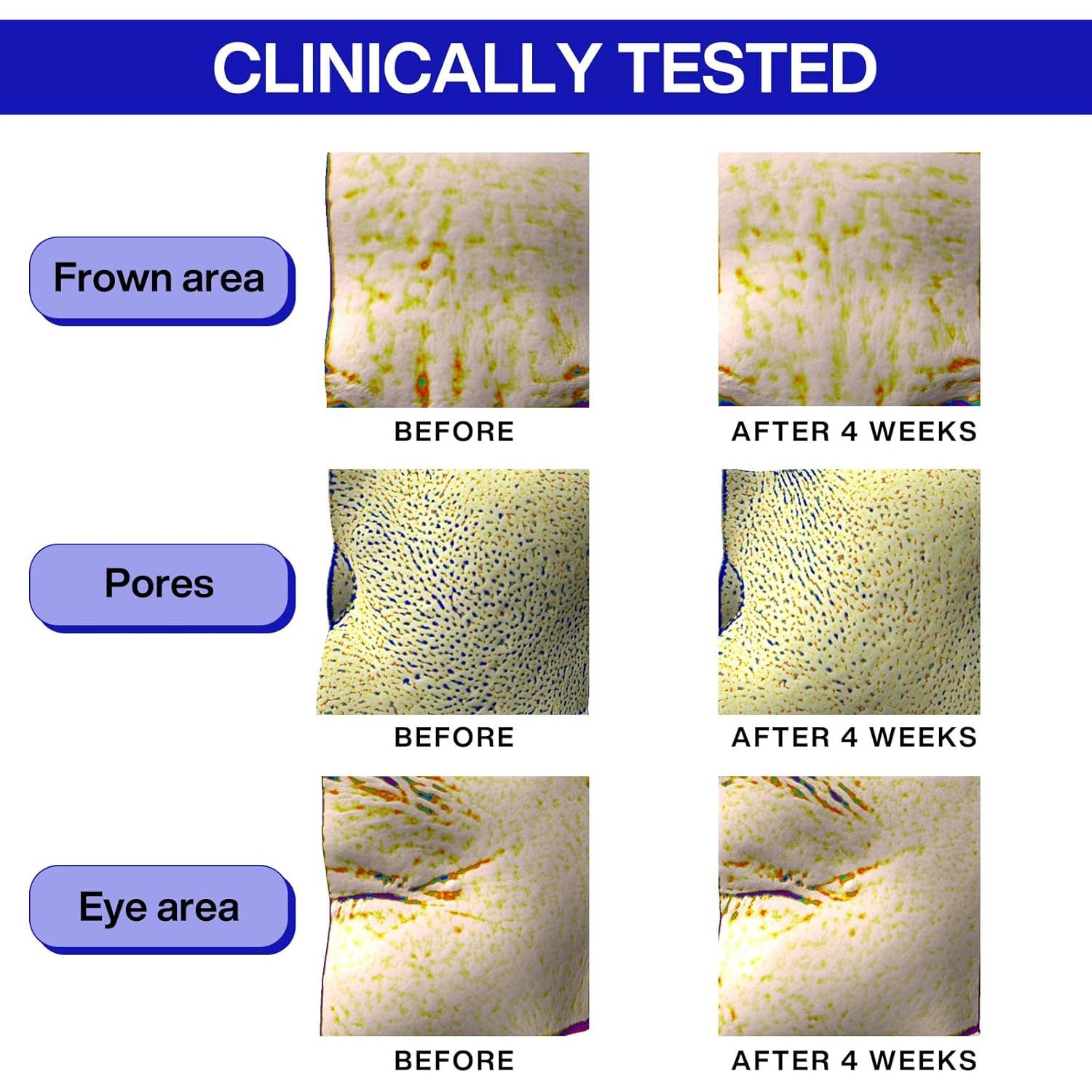 Suero Antienvejecimiento IOPE PDRN con Cafeína y Retinol 30ml