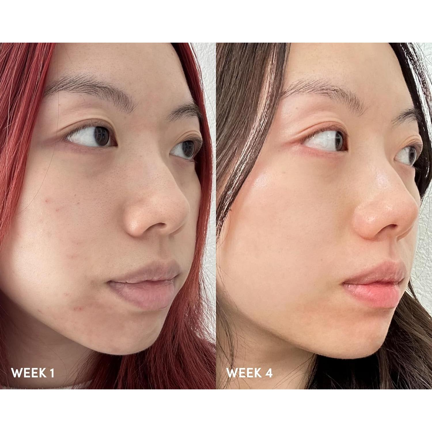 Sérum Exfoliante Goodal Manzana y Menta 50 ml AHA BHA