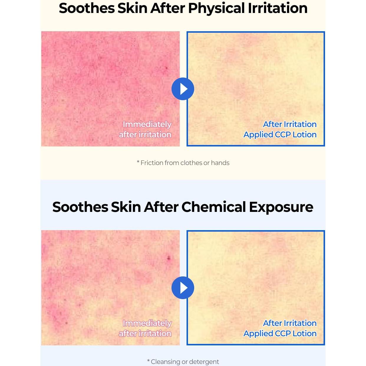 Loción Hidratante Coreana Loción CCP 120 ml - Piel Sensible