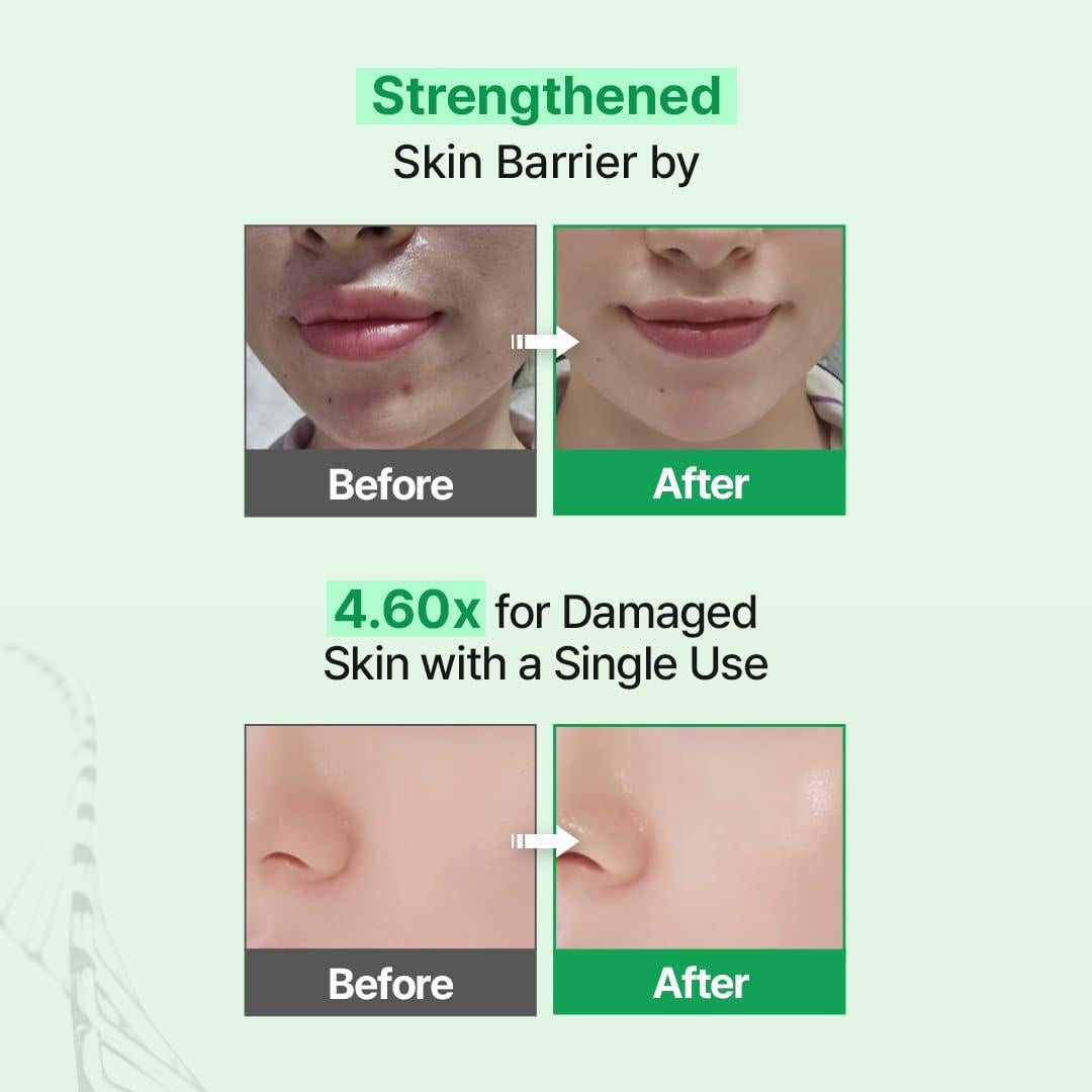 Zipiderm Ampolla Hidratante 30 ml - EGF, 5 Ceramidas, PDRN