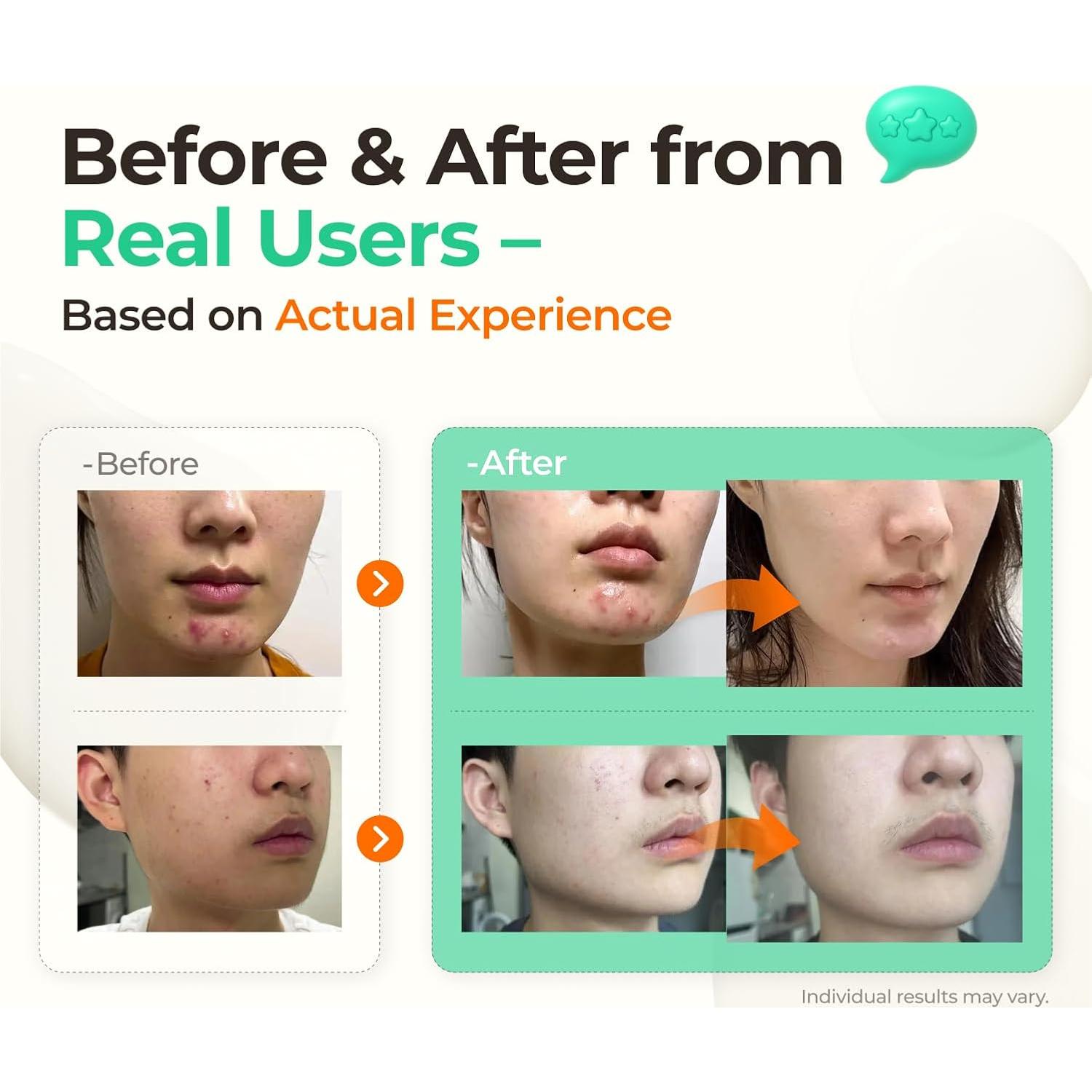 Suero Facial Calmante Wonderwall 50ml - 82% Agua Termal de Azufre