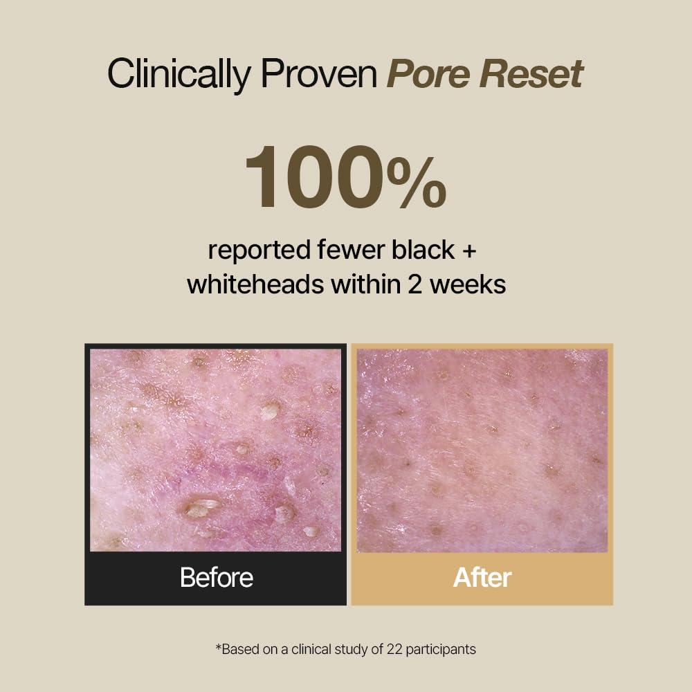 NDP Rice Mochi Espuma Limpiadora Exfoliante 120 ml