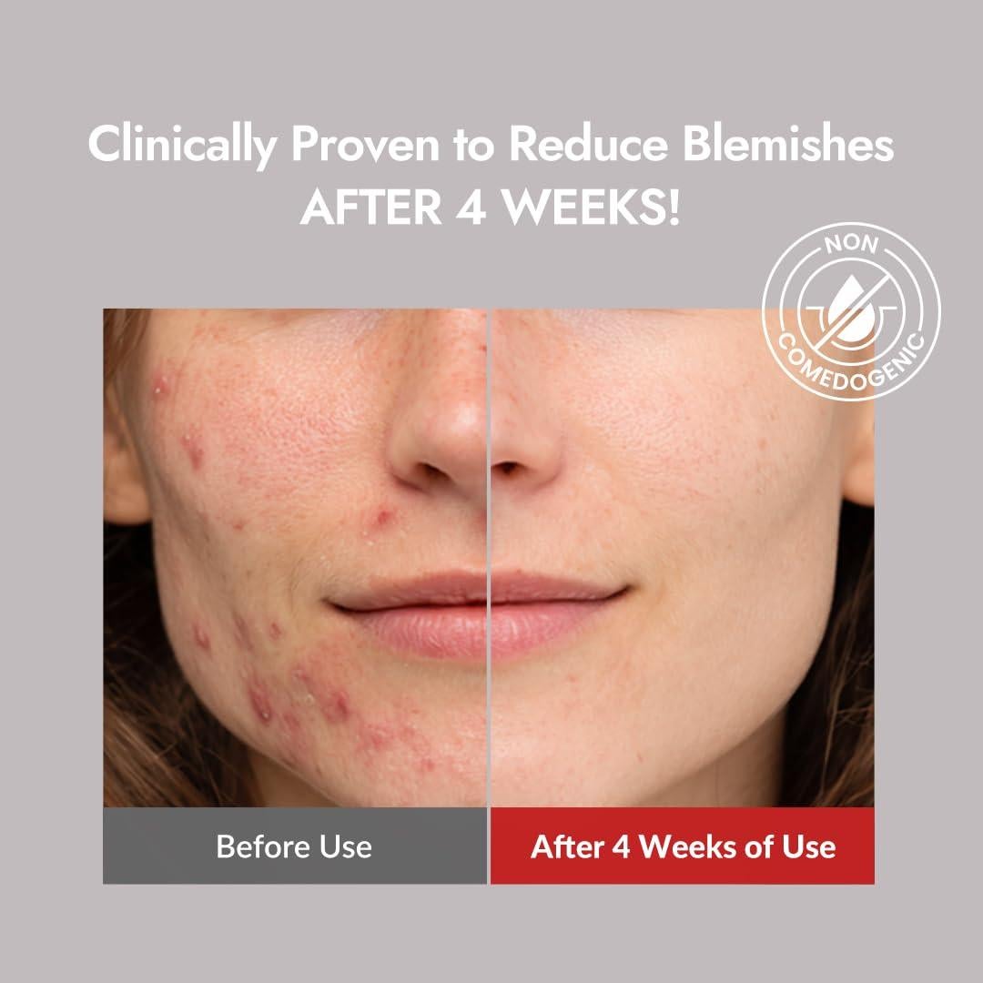 MIZON Limpiador Bajo pH 100ml para Piel con Acné y Sensible