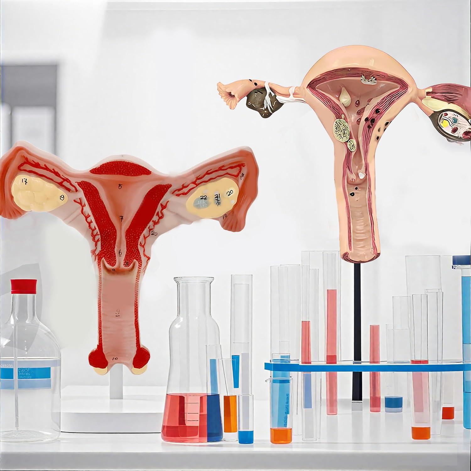 Modelo Anatómico de Útero y Ovarios DRXRD 2 Piezas Realista