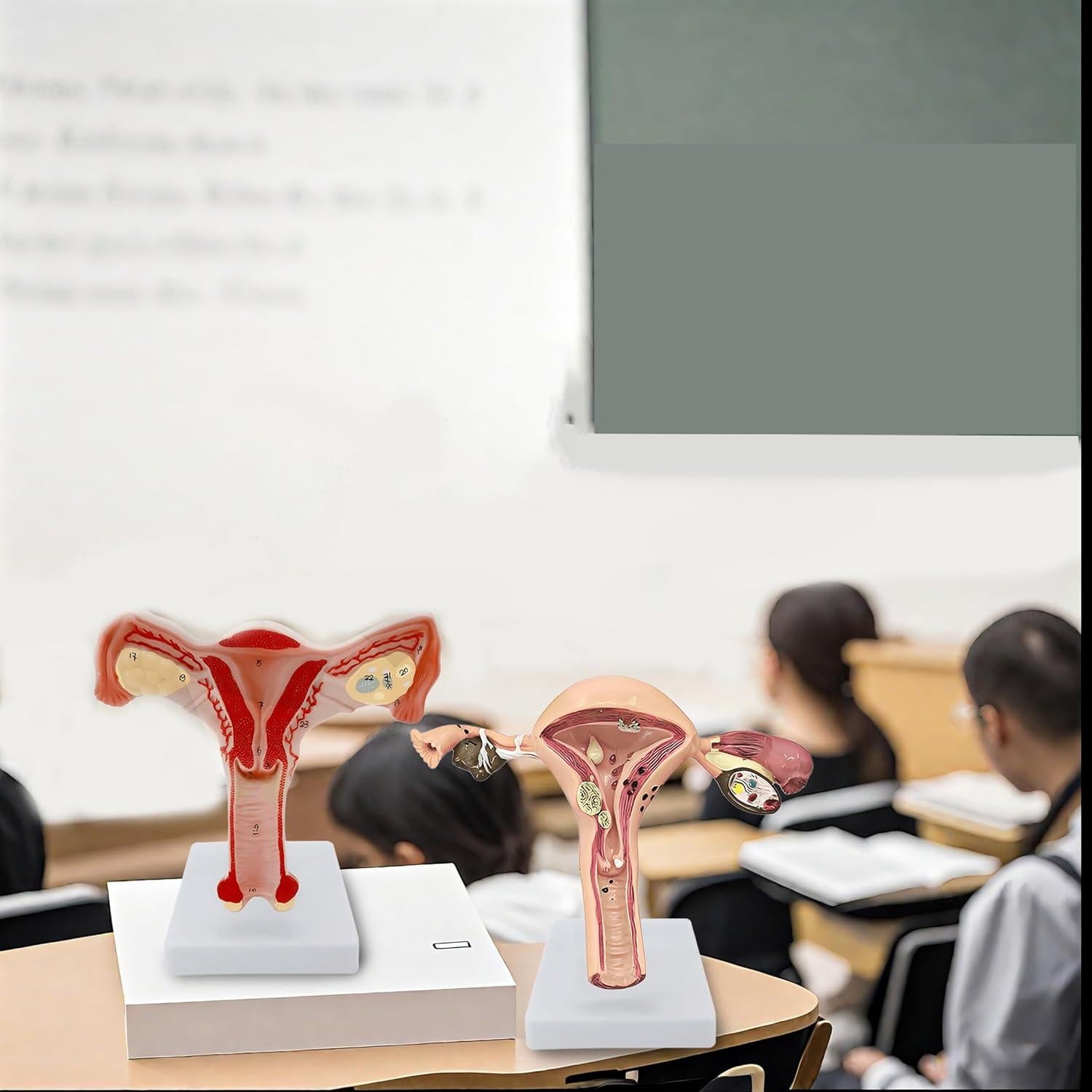 Modelo Anatómico de Útero y Ovarios DRXRD 2 Piezas Realista