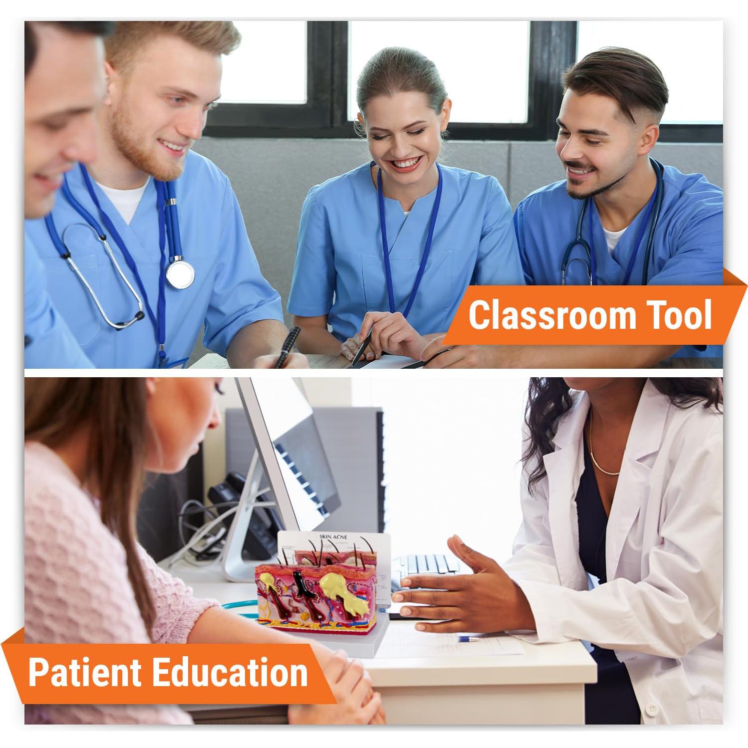 Modelo Anatómico de Piel con Acné GPI Anatomicals 18.42x18.42cm