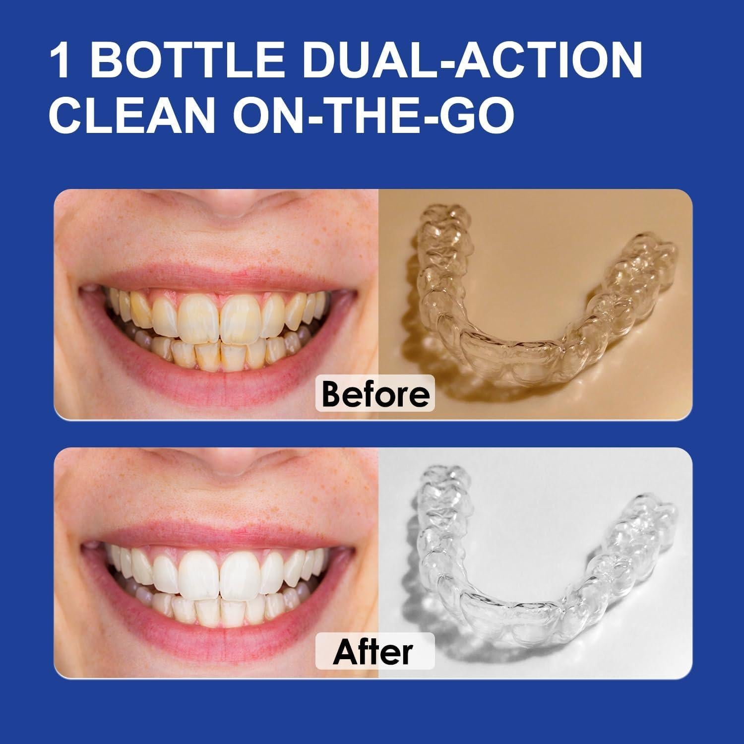 Limpiador 2-en-1 MySmile para Alineadores y Blanqueador de Dientes