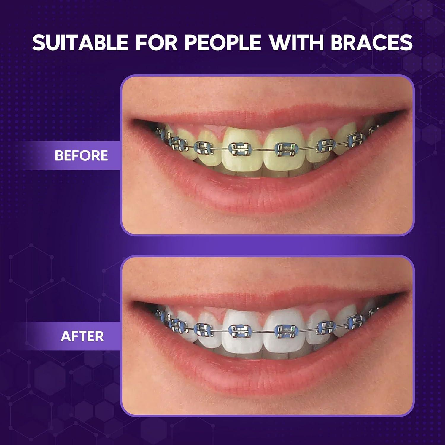 Espuma Blanqueadora de Dientes Abera Púrpura 150 ml - Natural y Efectiva