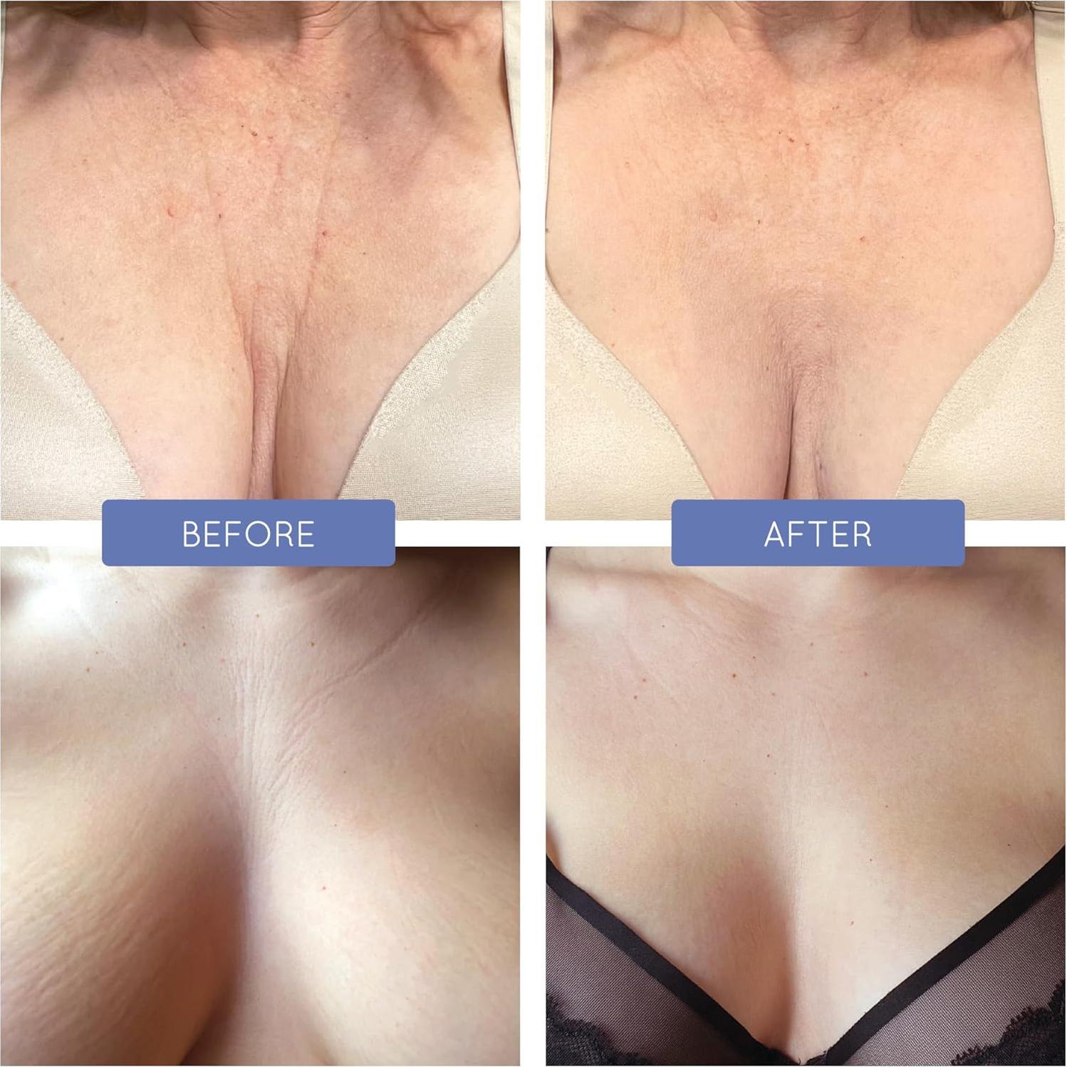 Sostén de Almohada Ajustable Soobi para Mujeres Talla C+