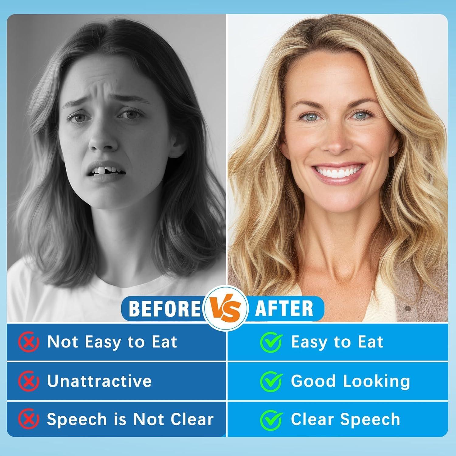 Dientes Falsos Moldables Aikaplus - Dentaduras Silicona 1PC