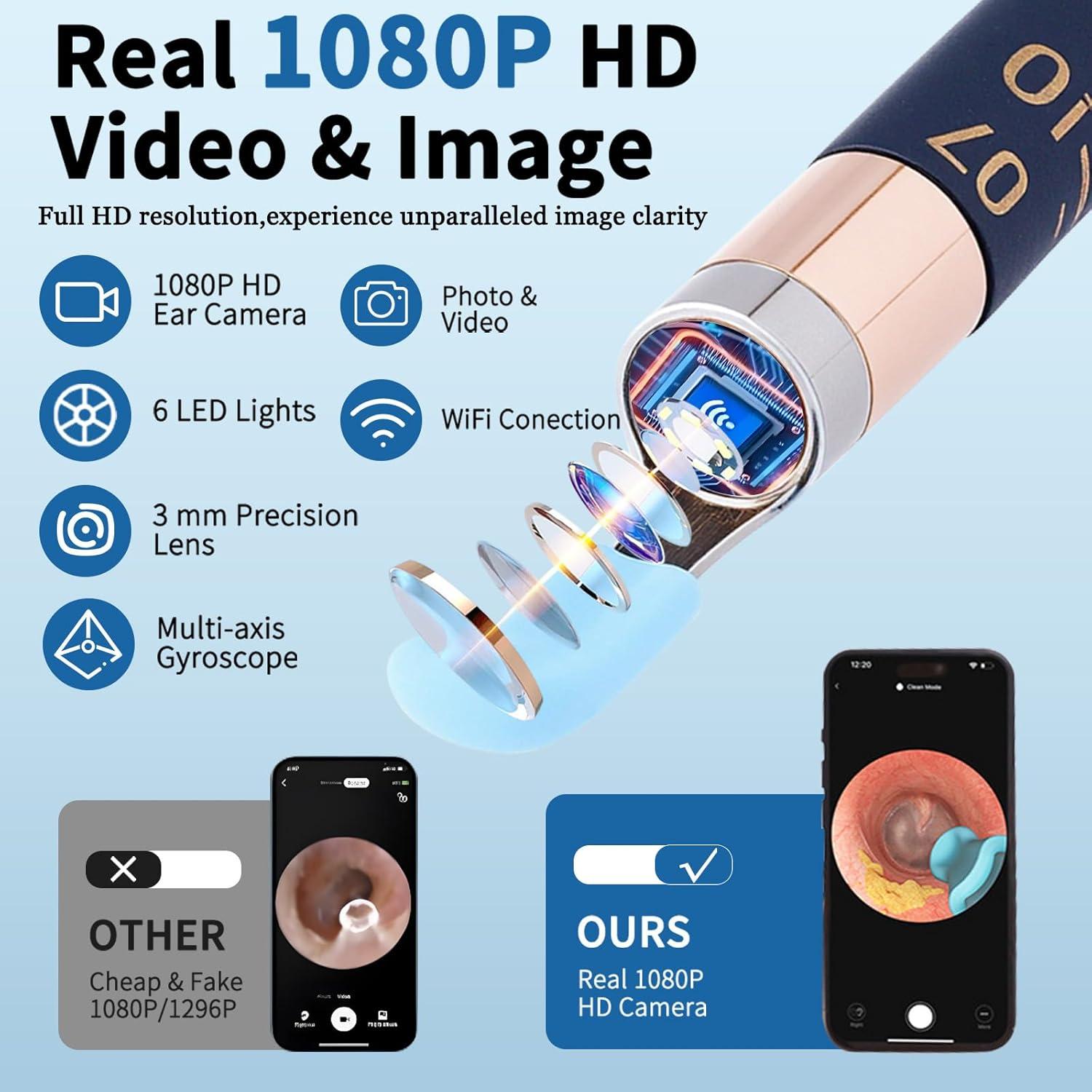 Limpiador de Oídos ZHIDE con Cámara 1080P y WiFi Inalámbrico