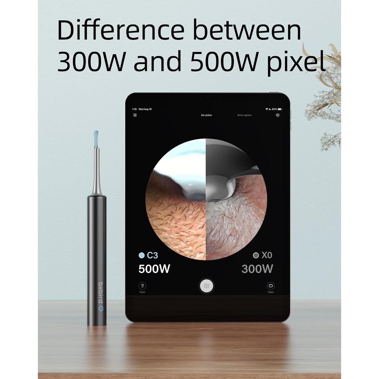 BEBIRD Limpiador de Oídos con Cámara 5MP 1080P y LED