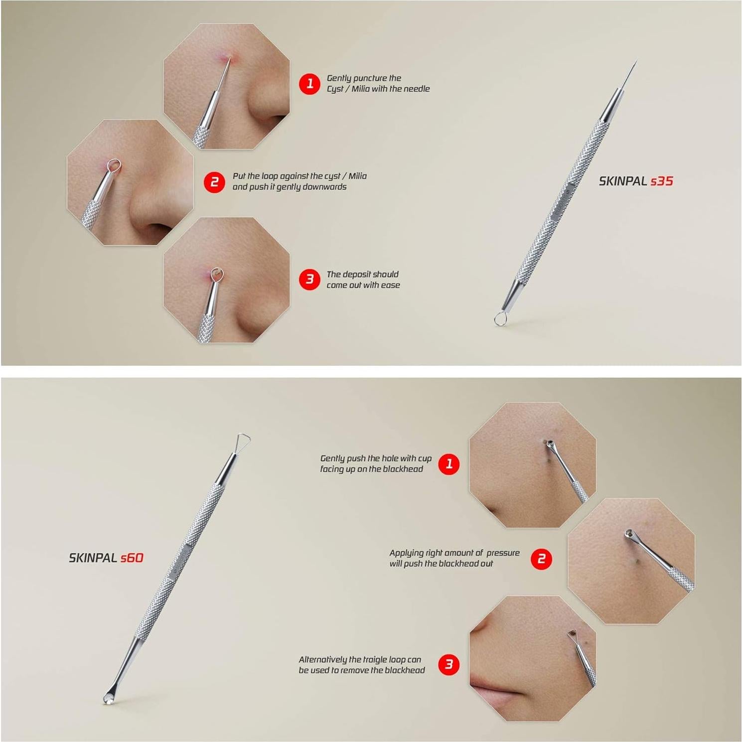 Kit de Herramientas Suvorna para Exprimir Espinillas 4 en 1