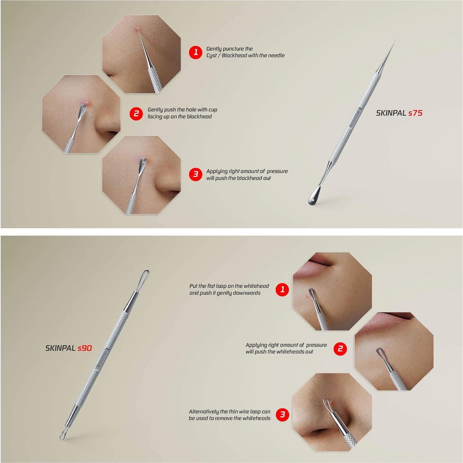 Kit de Herramientas Suvorna para Exprimir Espinillas 4 en 1