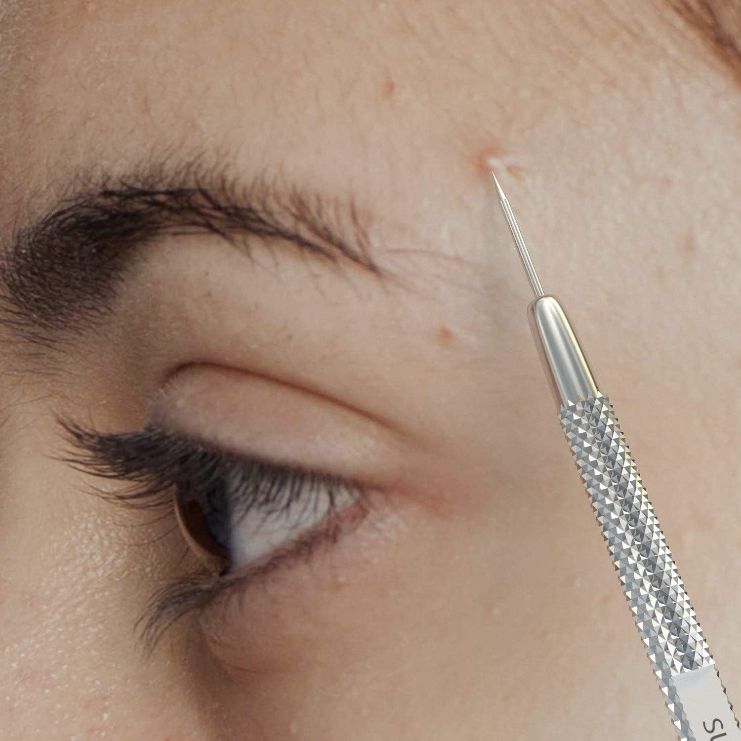 Kit de Herramientas Suvorna para Exprimir Espinillas 4 en 1