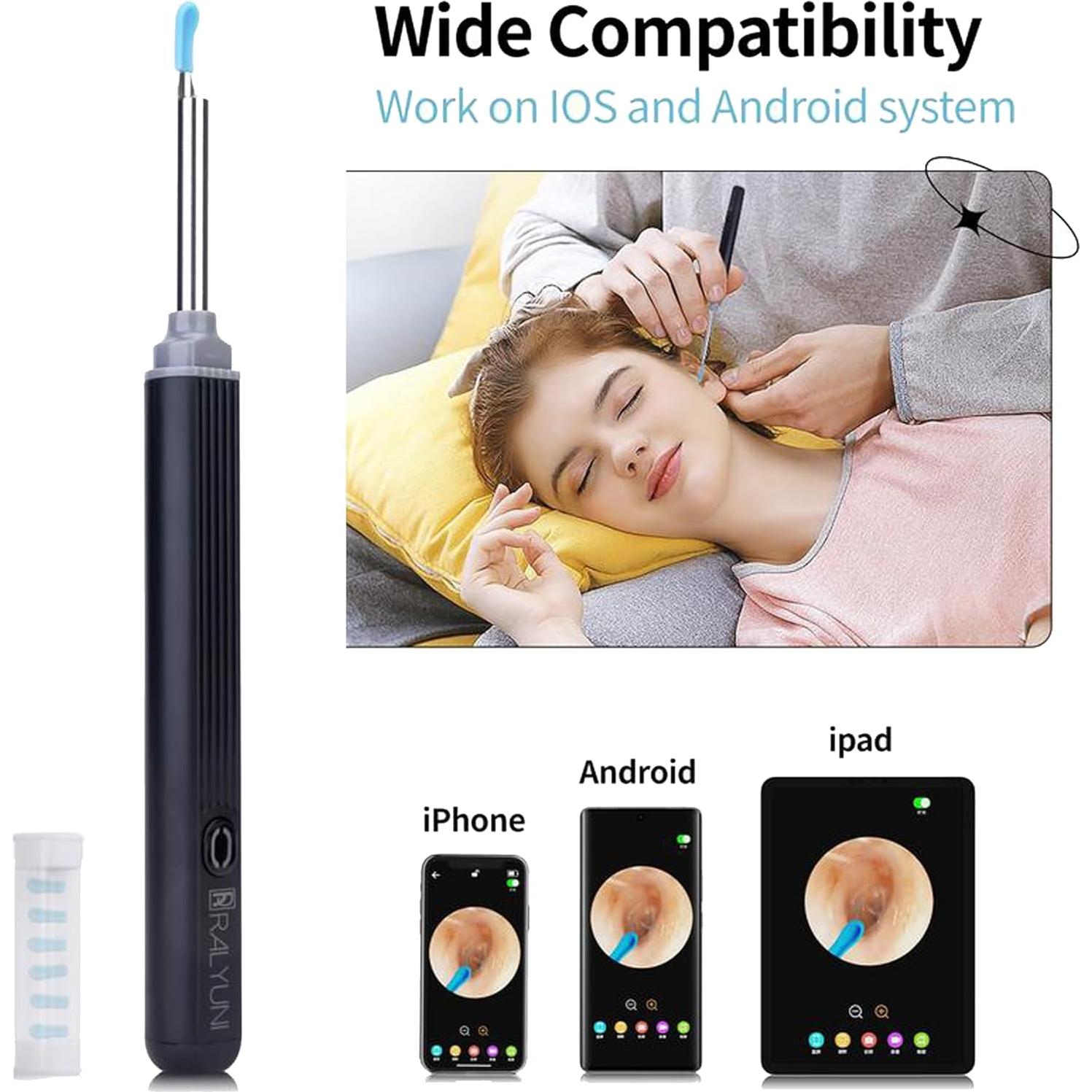 Otoscopio Inalámbrico 1080 HD Xinghuo con Luz LED y Punta de Silicona