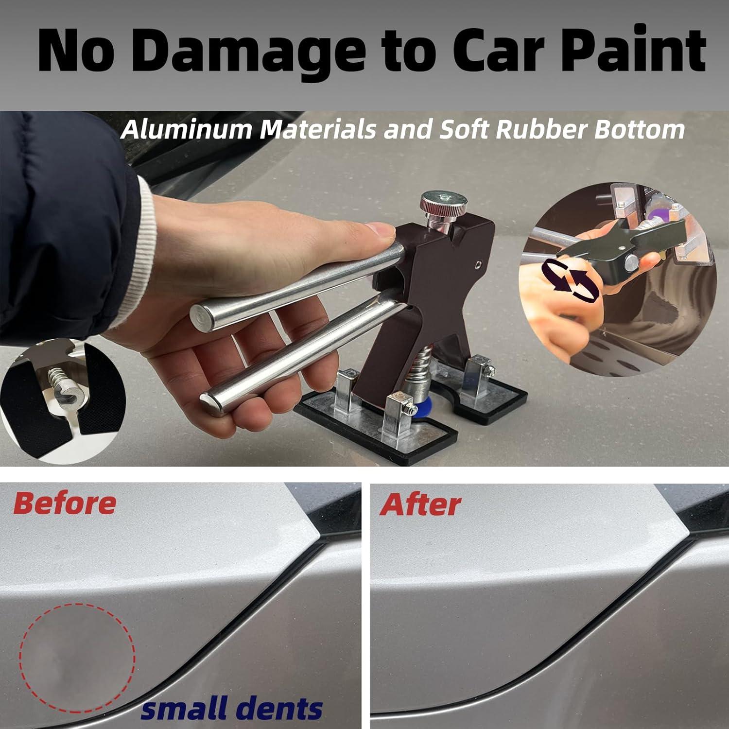 Kit de Extracción de Abolladuras NIUVOCY TZ147 147 Piezas