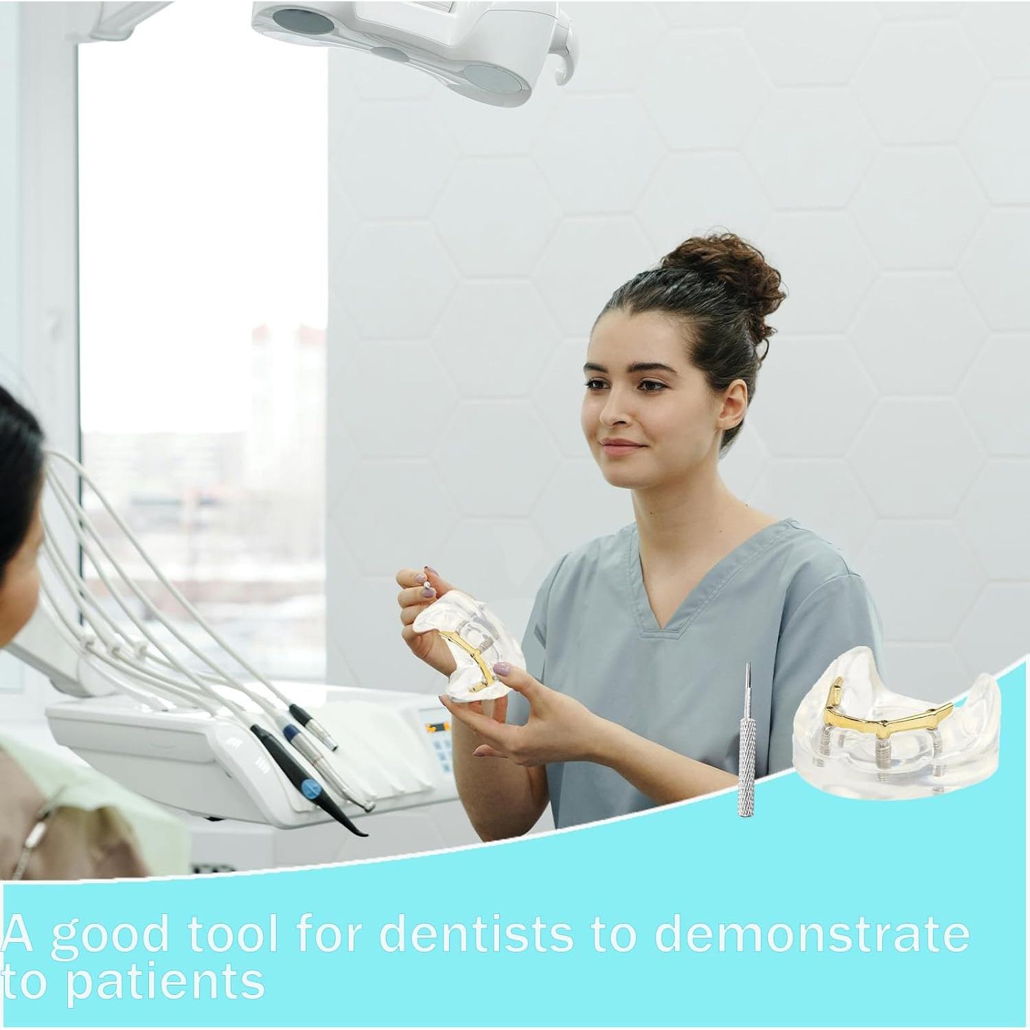 Modelo Dental Sobredentadura Kouyot Transparente 10.49x9.60cm