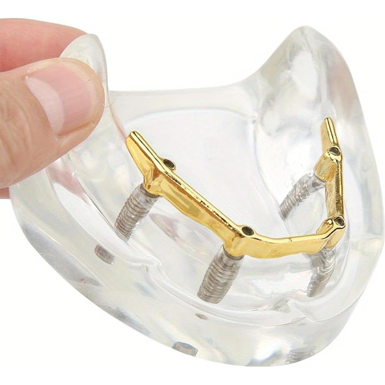 Modelo Dental Sobredentadura Kouyot Transparente 10.49x9.60cm