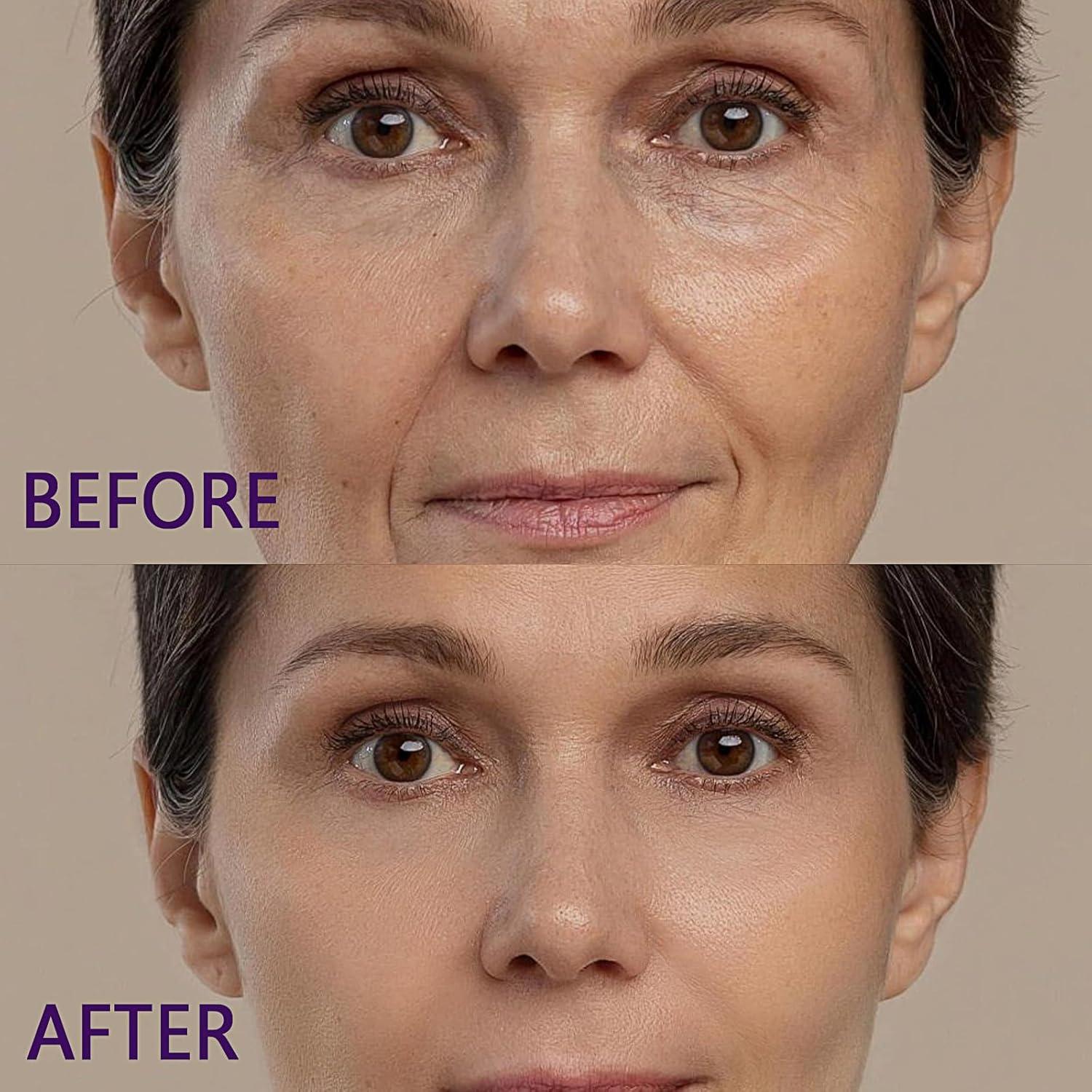 Bálsamo Hidratante Multi Calcio Coreano 9g - Antiarrugas