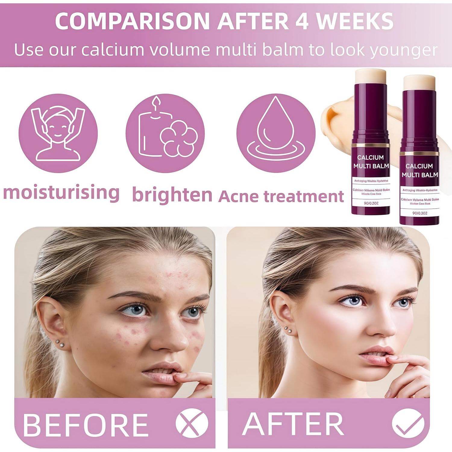 Bálsamo Hidratante Multi Calcio STDKDFW 2PCS 59g