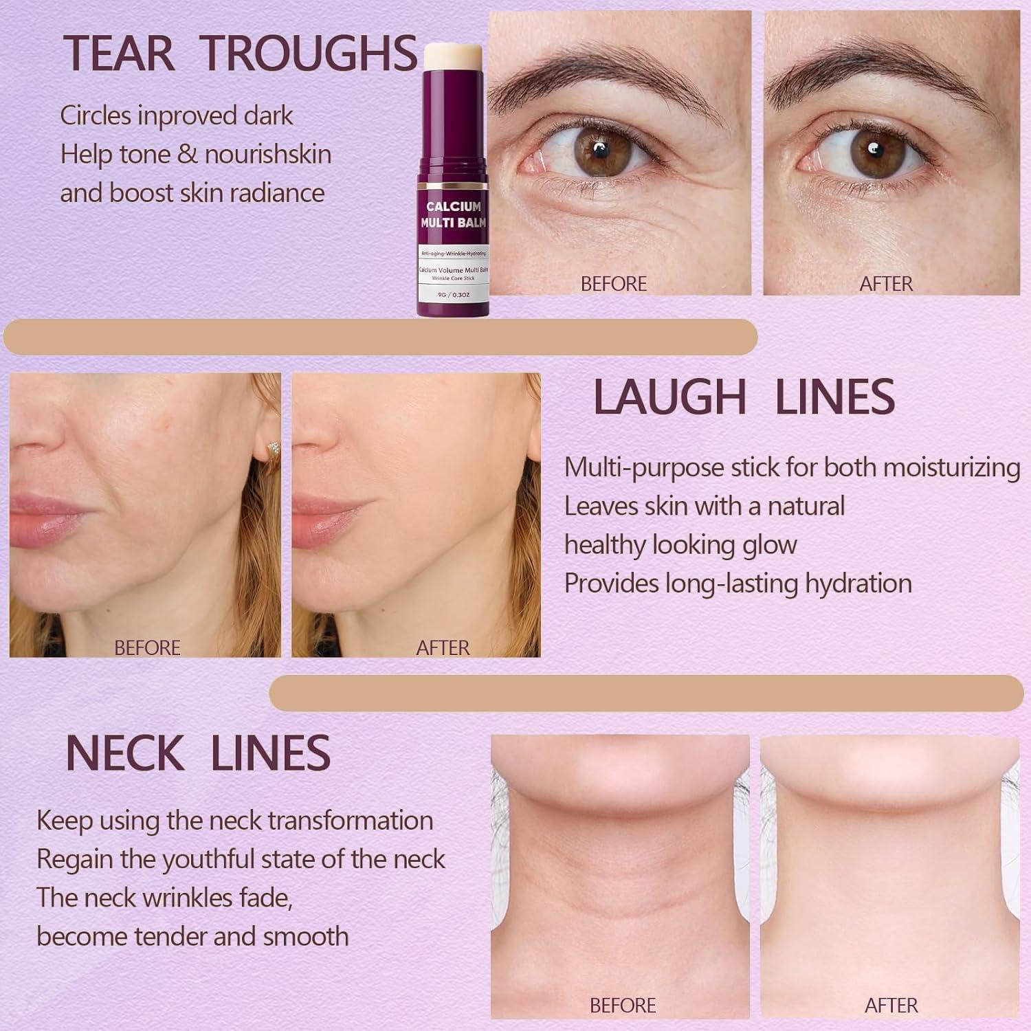 Bálsamo Multi Calcio ZARICS 10cm Hidratante para Piel