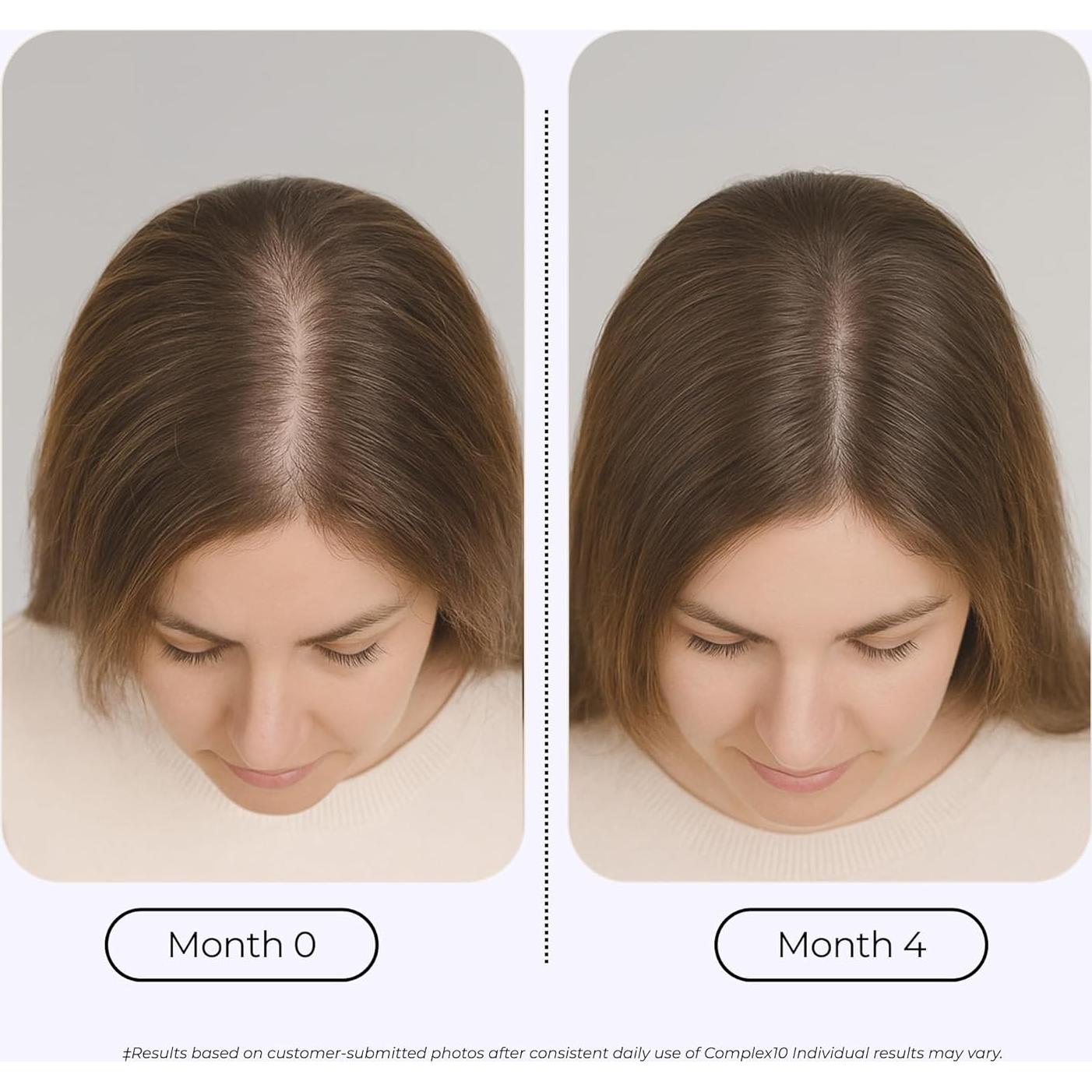 Suplemento para Cabello Growplex Complex10 con Biotina y Colágeno - 30 Cápsulas