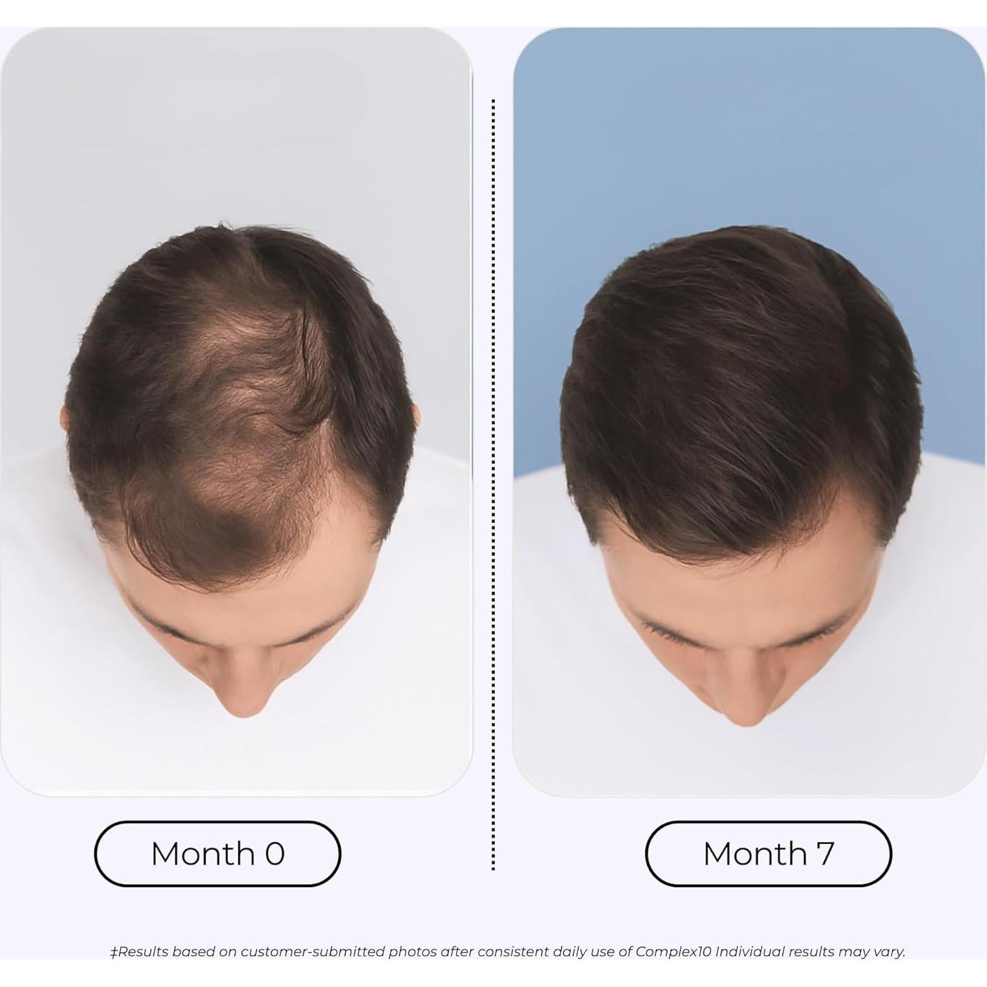 Suplemento para Cabello Growplex Complex10 con Biotina y Colágeno - 30 Cápsulas