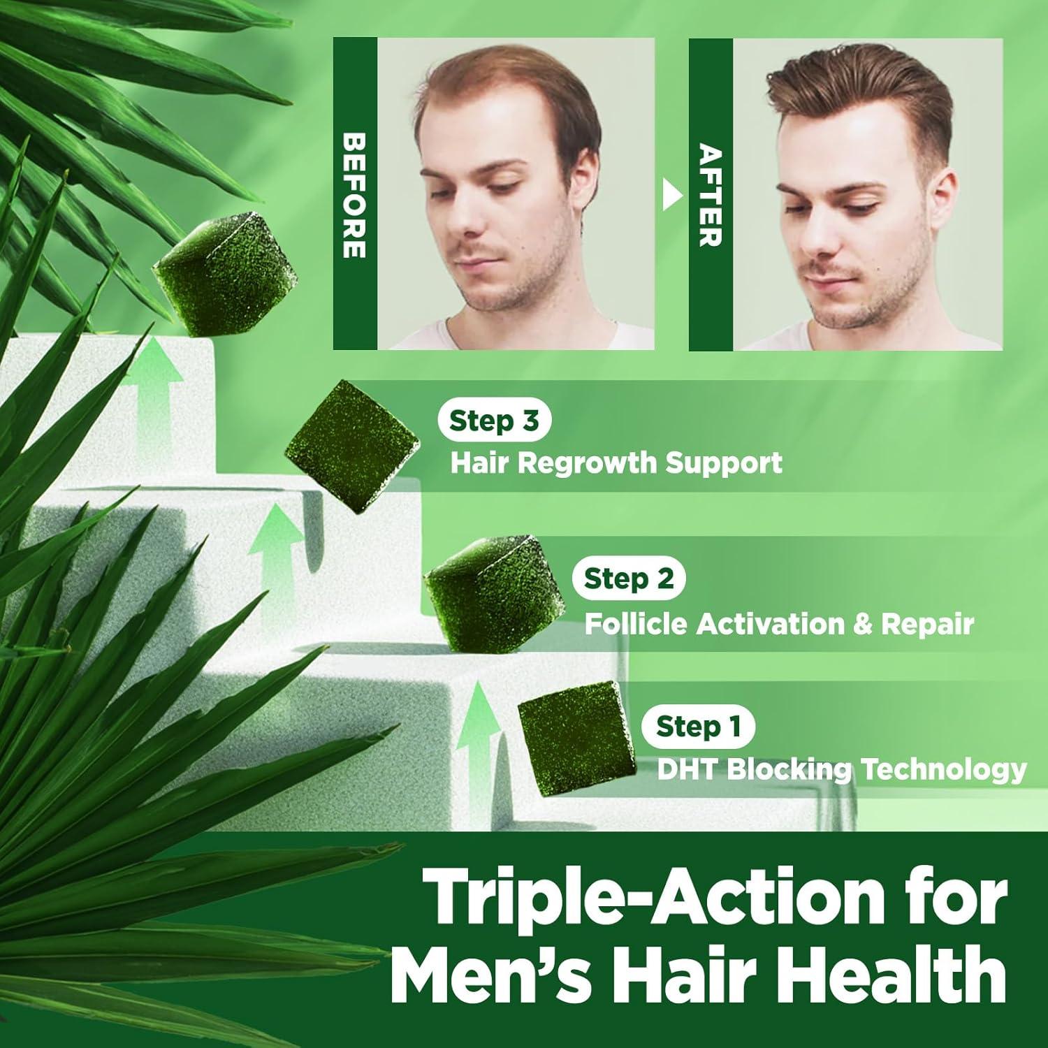 Gomitas de Saw Palmetto Orgánico Newtrisland 60 Unidades