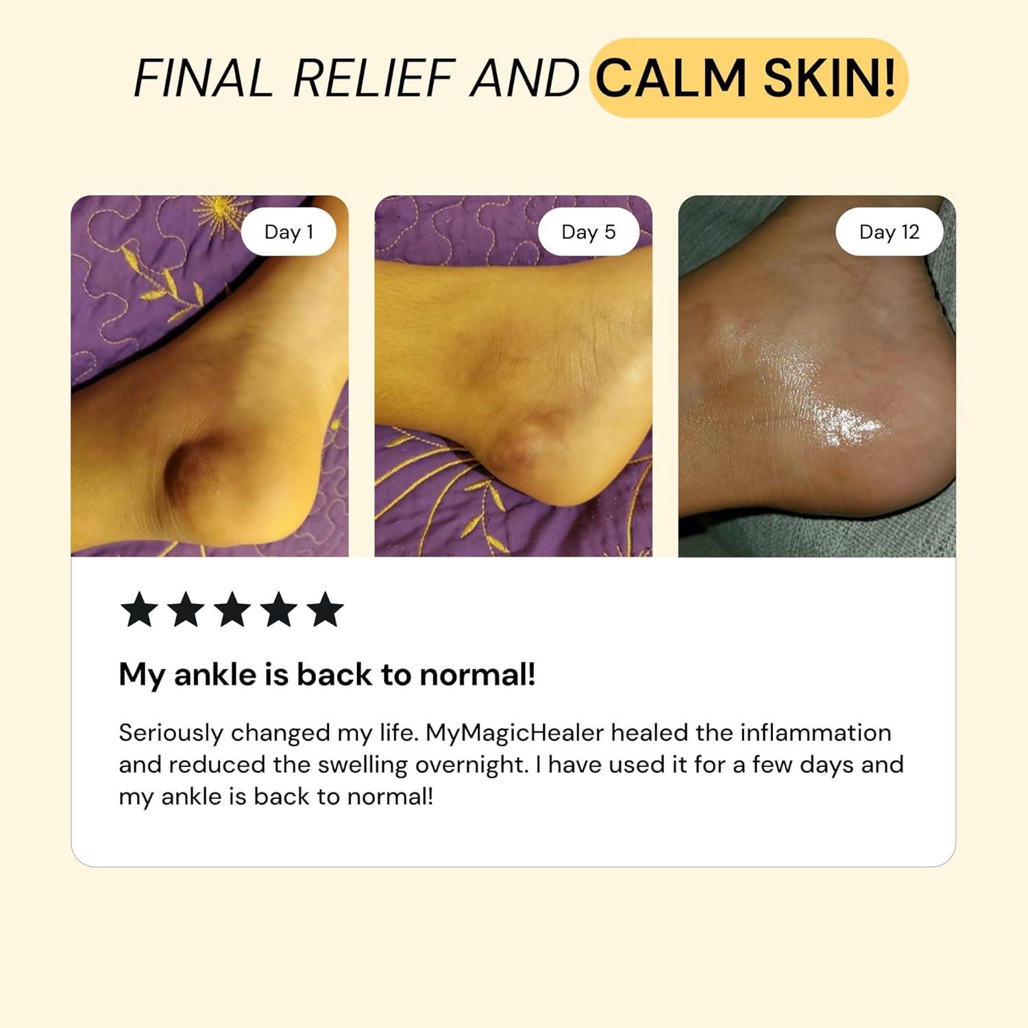 MyMagicHealer Ungüento Alivio Dolor Muscular 56.7g