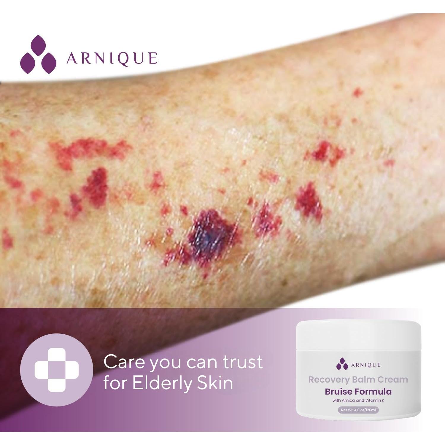 Bálsamo para Moretones Arnique con Vitamina K - 113g