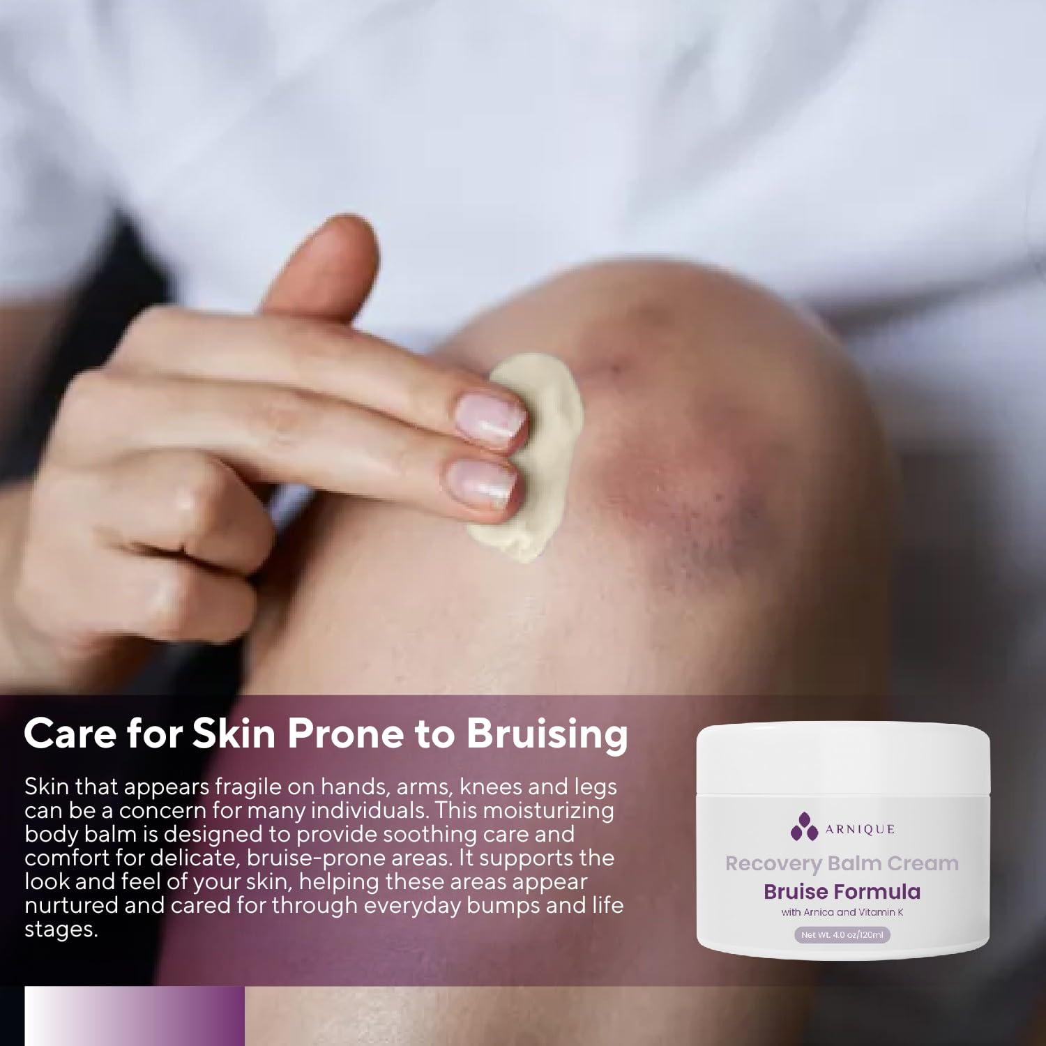 Bálsamo para Moretones Arnique con Vitamina K - 113g