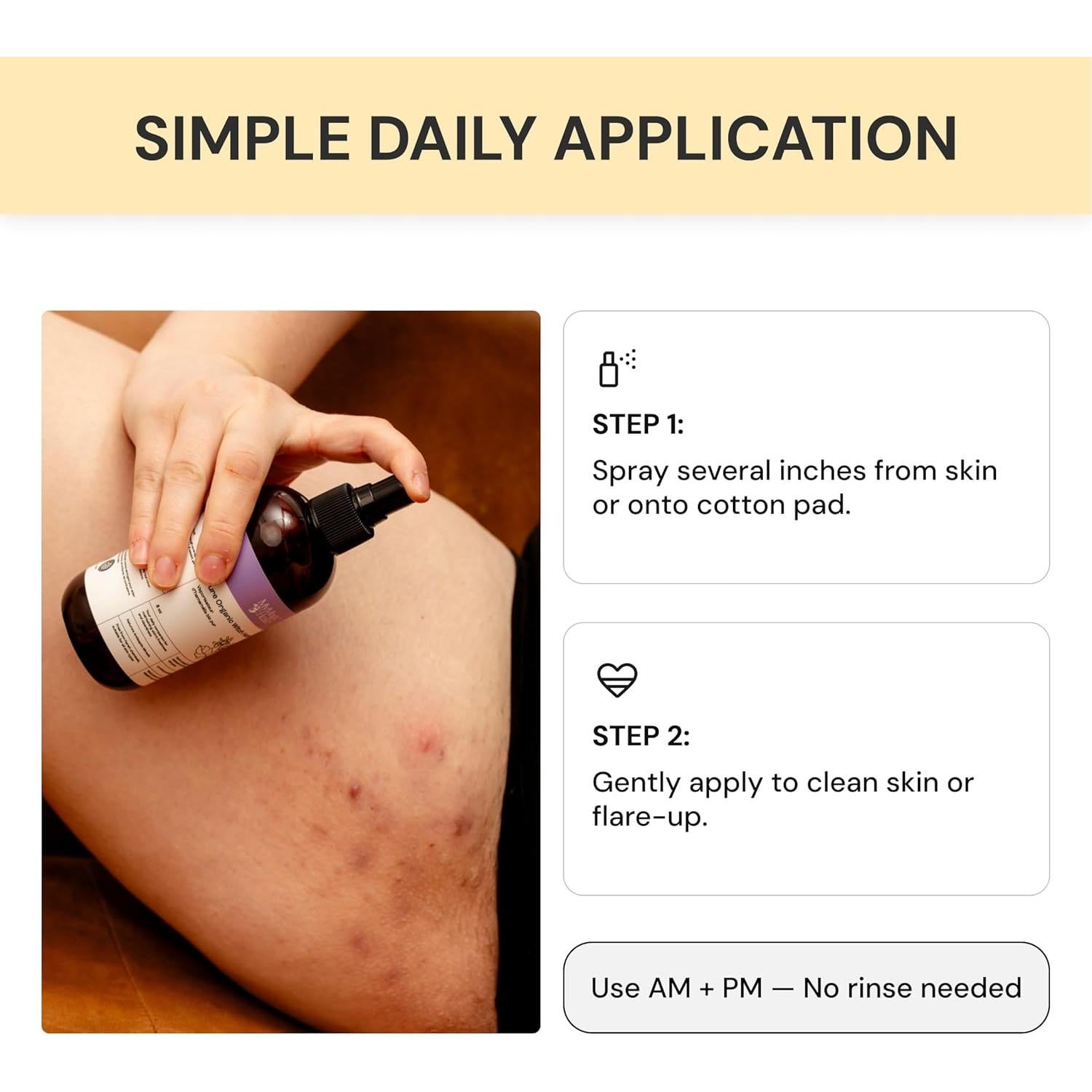 Spray de Hamamelis Orgánico MyMagicHealer 226.8 ml - Alivio Piel Irritada