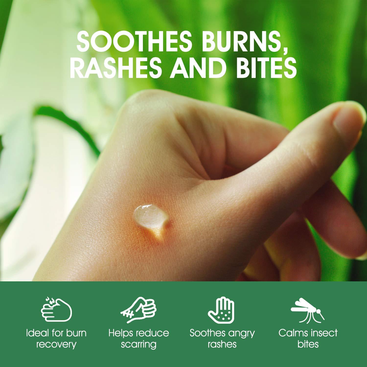 Gel de Aloe Vera Puro Oriso 295 ml - Hidratante Calmante