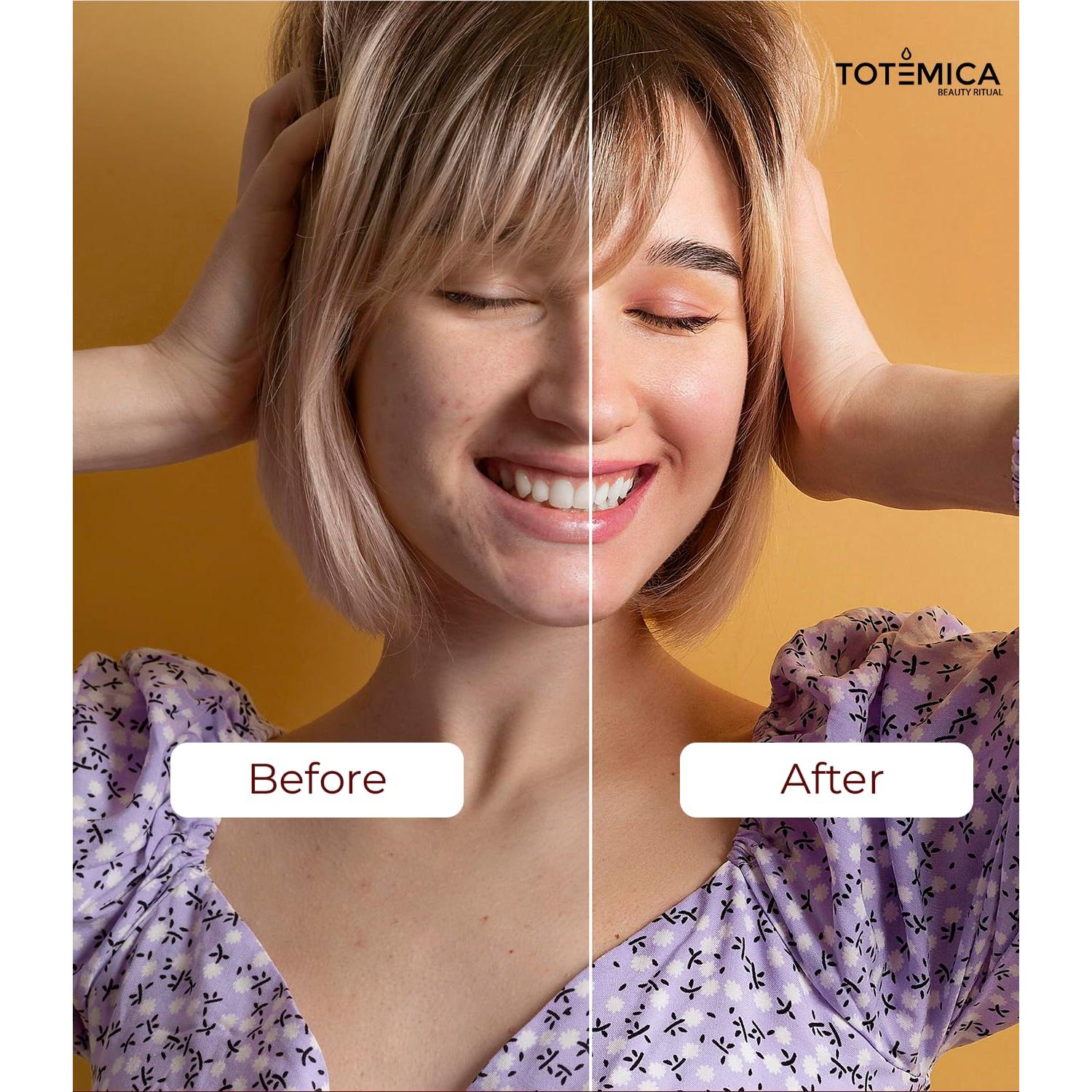 Aceite de Jojoba Orgánico Totemica 30 ml - Hidratante Facial y Corporal