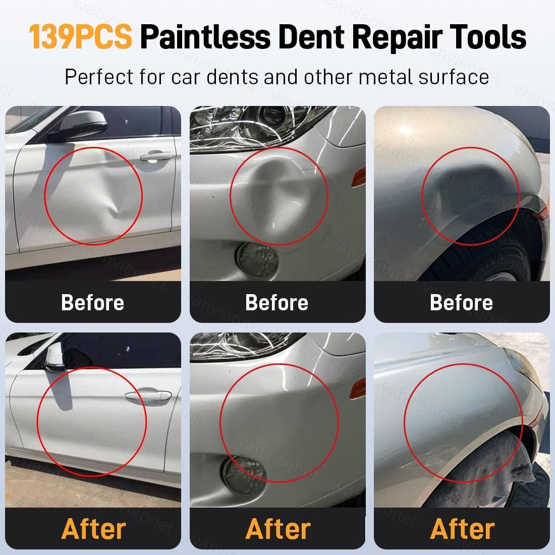 Kit de Extracción de Abolladuras Wanvieonet 139 Piezas