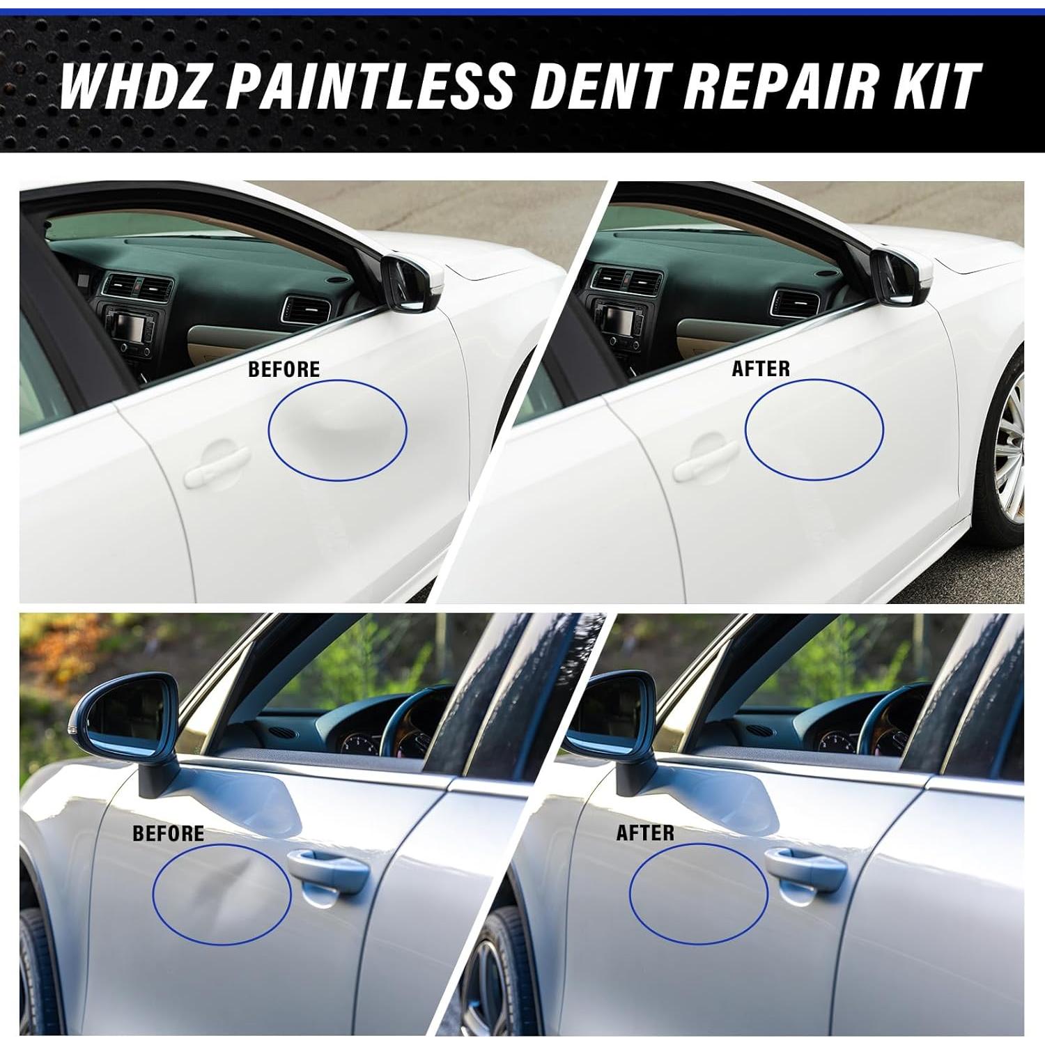 Kit de Reparación de Abolladuras WHDZ 2 en 1 con Extractores