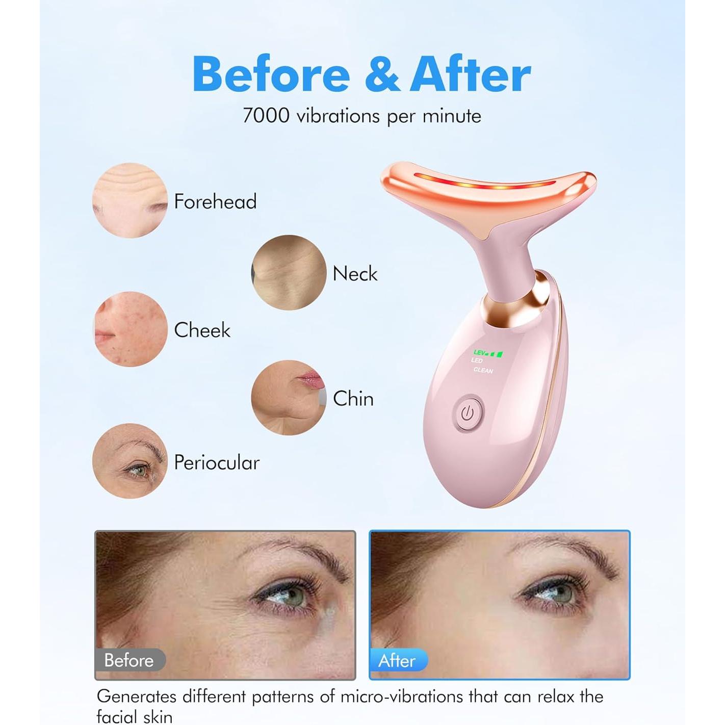 Masajeador Facial Sunpint ES-1081 7 Colores para Arrugas