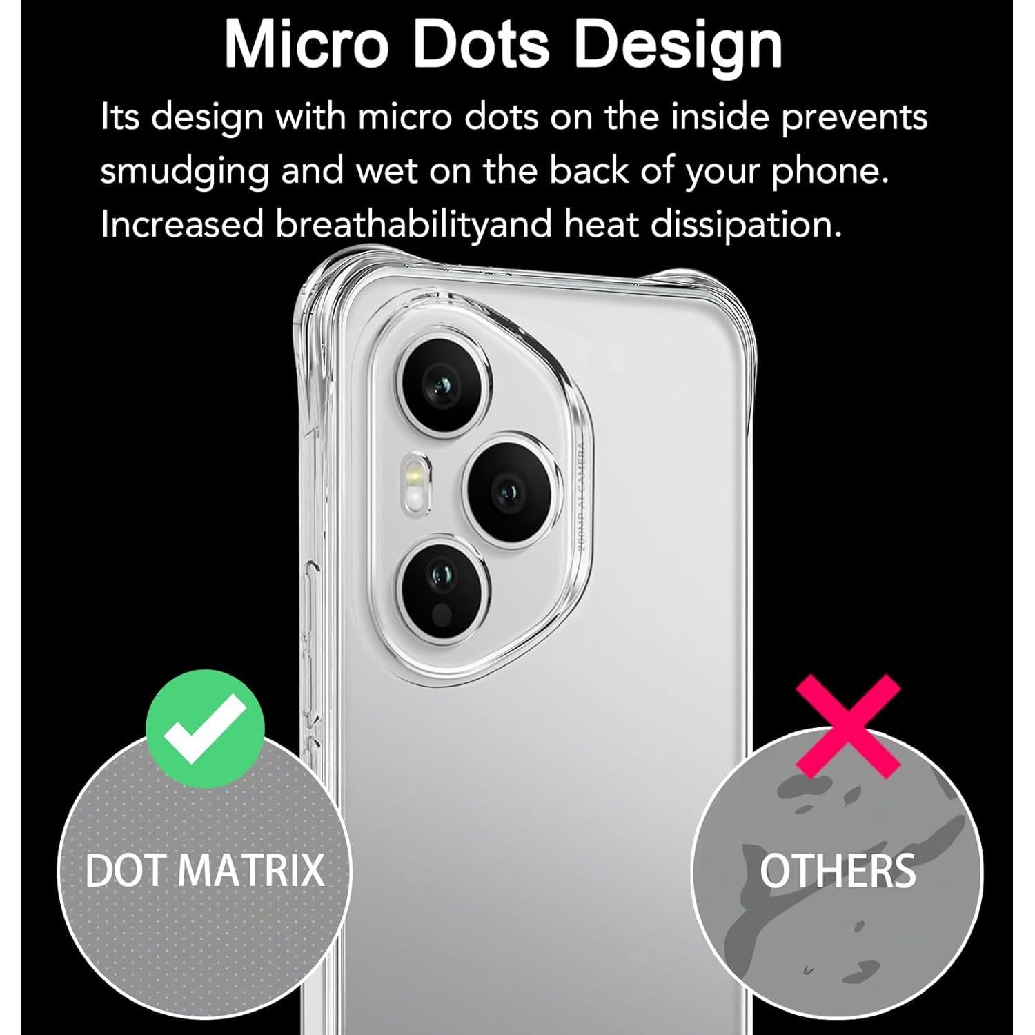 Funda TPU Transparente USTIYA para Honor 400 Pro 5G