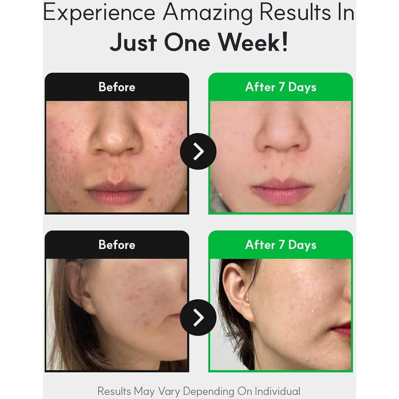 Crema Calmante Centelsome 5X 50ml - Hidratante Facial Coreano